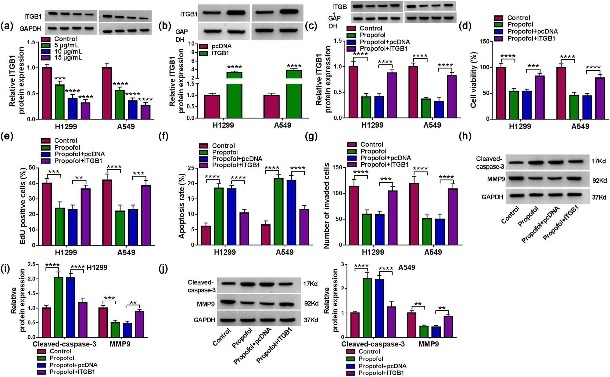 Figure A2 
               Propofol controlled NSCLC cell proliferation, invasion, and apoptosis by miR-153-3p. (a) Detection of miR-153-3p in NSCLC cells treated with 5, 10, and 15 μg/mL propofol using RT-qPCR (n = 3). (b) Assessment of the transfection efficiency of miR-153-3p inhibitor using RT-qPCR (n = 3). (c) Influence of miR-153-3p inhibitor on miR-153-3p expression in propofol-treated NSCLC cells was evaluated using RT-qPCR (n = 3). (d–g) Effects of miR-153-3p silencing on propofol-treated NSCLC cell viability, proliferation, apoptosis, and invasion were evaluated using MTT, EdU, flow cytometry, and transwell assays (n = 3). (h–j) Western blotting analysis of the impacts of miR-153-3p knockdown on protein levels of Cleaved-caspase3 and MMP9 in propofol-treated NSCLC cells (n = 3). *P < 0.01, **P < 0.01, ***P < 0.001, and ****P < 0.0001.
            