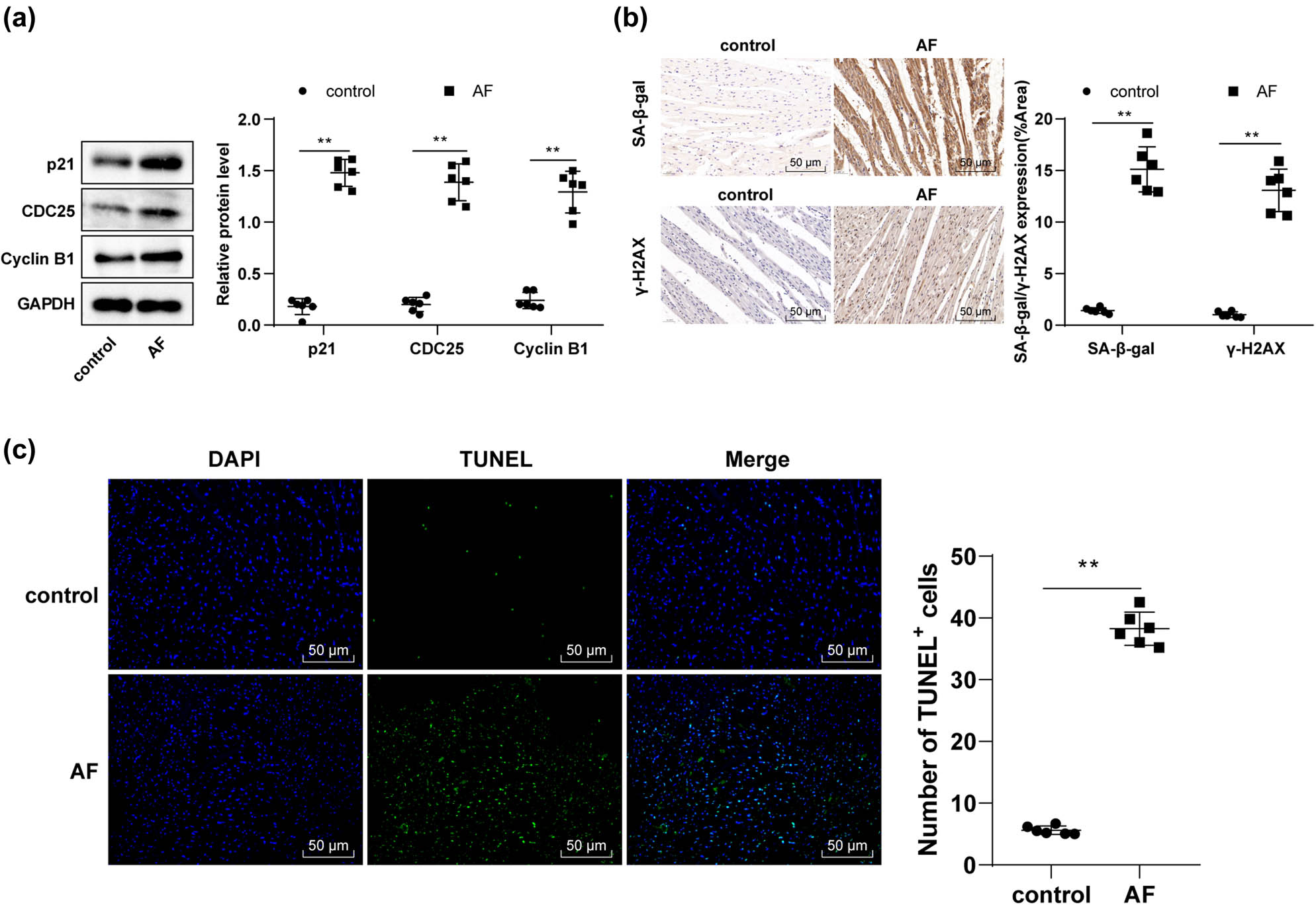 Figure 4 
                  AF upregulated p21 to trigger cell cycle arrest, senescence, and apoptosis in rat cardiomyocytes. (a) Western blotting determined p21, CDC25, and Cyclin B1 protein levels in myocardial tissues; (b) immunohistochemistry assay determined SA-β-gal and γ-H2AX levels in myocardial tissues; (c) TUNEL staining evaluated cell apoptosis. N = 6. An independent sample t-test was used for comparisons between two groups. **p < 0.01.
               