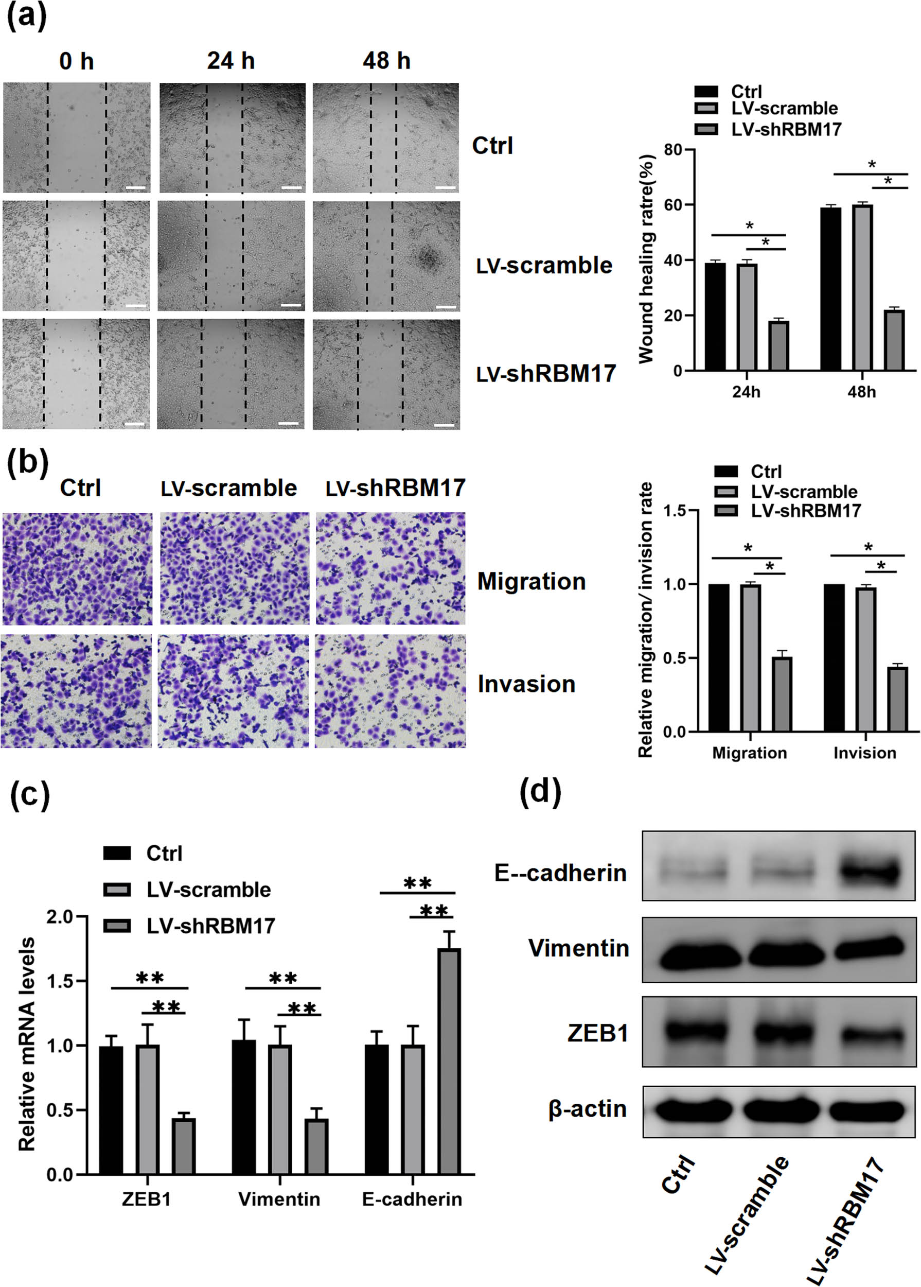 Figure 3
Knockdown of RBM17 affects FaDu cell invasion, migration, and EMT. (a) Cell migration ability was examined by the wound-healing assay. Images were taken using a 4× objective lens. (b) The cell invasion ability was investigated using a Transwell assay. (c and d) ZEB1, Vimentin, and E-cadherin expressions in LV-shRBM17 and LV-scramble cells were detected by qRT-PCR and western blot. *P < 0.05, **P < 0.01.