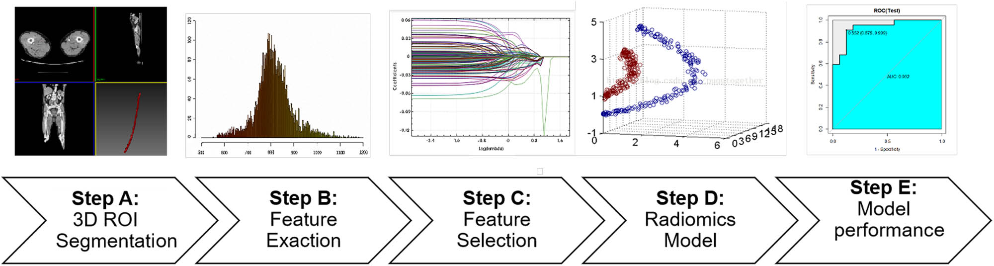 Figure 1 
               Research workflow. A: Three-dimensional (3D) ROIs were segmented from CTA images; B and C: Quantitative imaging texture features were extracted and selected to construct the radiomics model; D: Three different radiomics models were constructed; E: ROC curve analysis was used to evaluate the performance of the model.
            