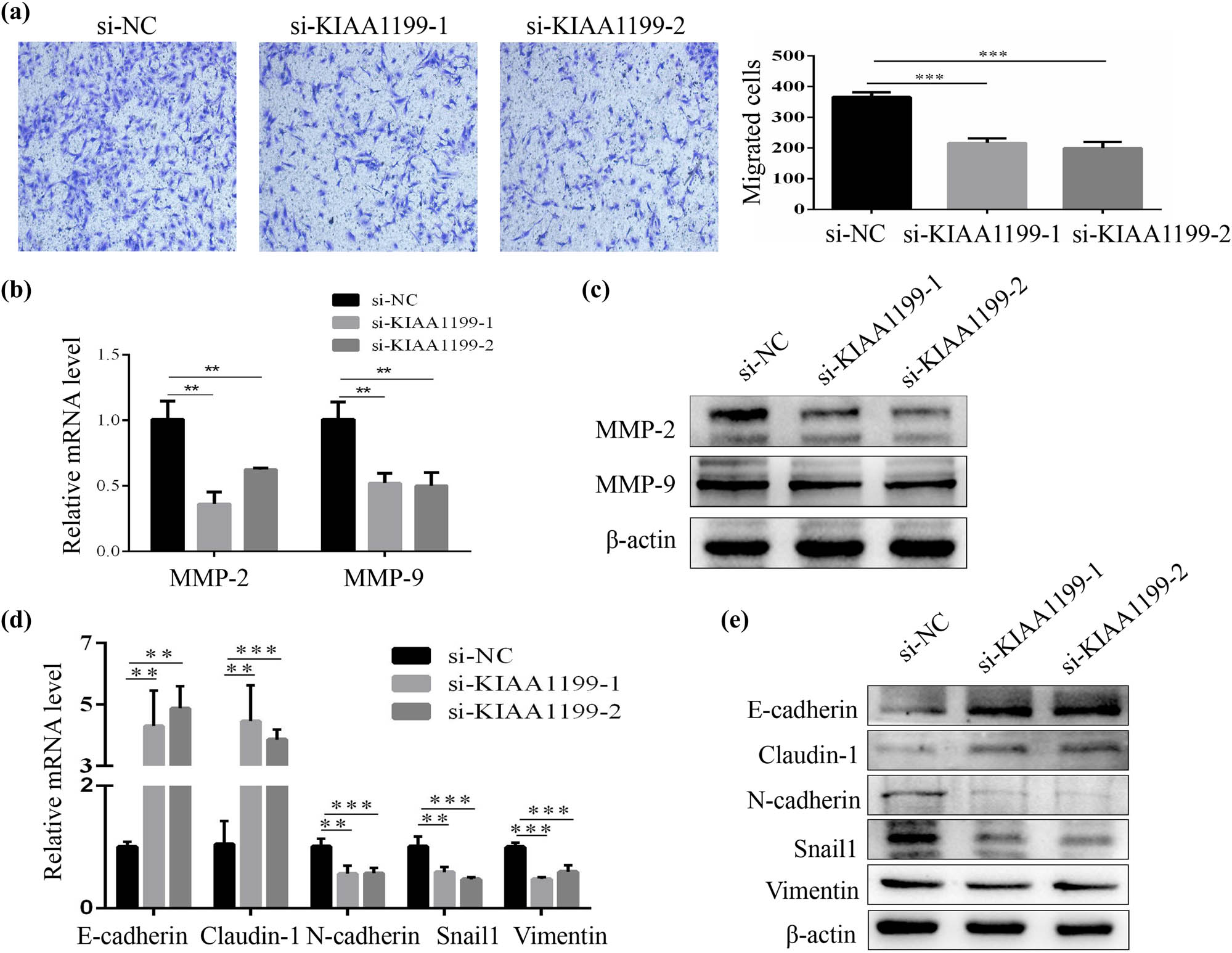 Figure 4 
                  KIAA1199 knockdown inhibited HSC migration and suppressed EMT. (a) Cell migration in LX-2 cells (100×) was analyzed using the Transwell assay. (b) RT-qPCR and (c) western blot analysis of MMP-2 and MMP-9 expression in LX-2 cells transfected with siRNAs (si NC or si KIAA1199). (d) RT-qPCR and (e) western blot analysis of E-cadherin, Claudin-1, N-cadherin, Snail1, and vimentin expression in LX-2 cells transfected with siRNAs (si NC or si KIAA1199). β-Actin was used as a loading control. Each bar represents mean ± standard deviation of three separate experiments. **
                     P < 0.01 and ***
                     P < 0.001.
               
