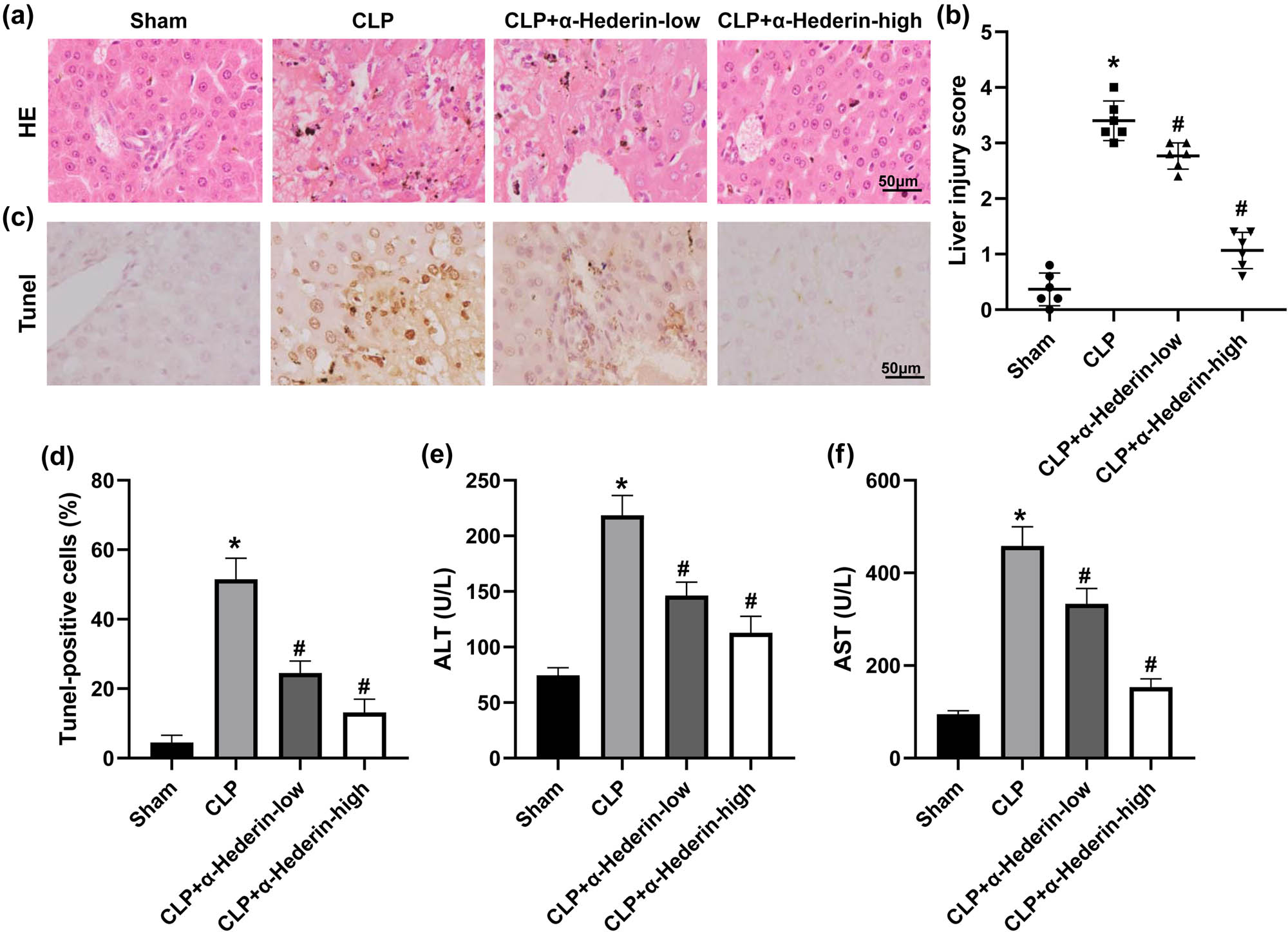 α-Hederin regulates macrophage polarization to relieve sepsis-induced ...