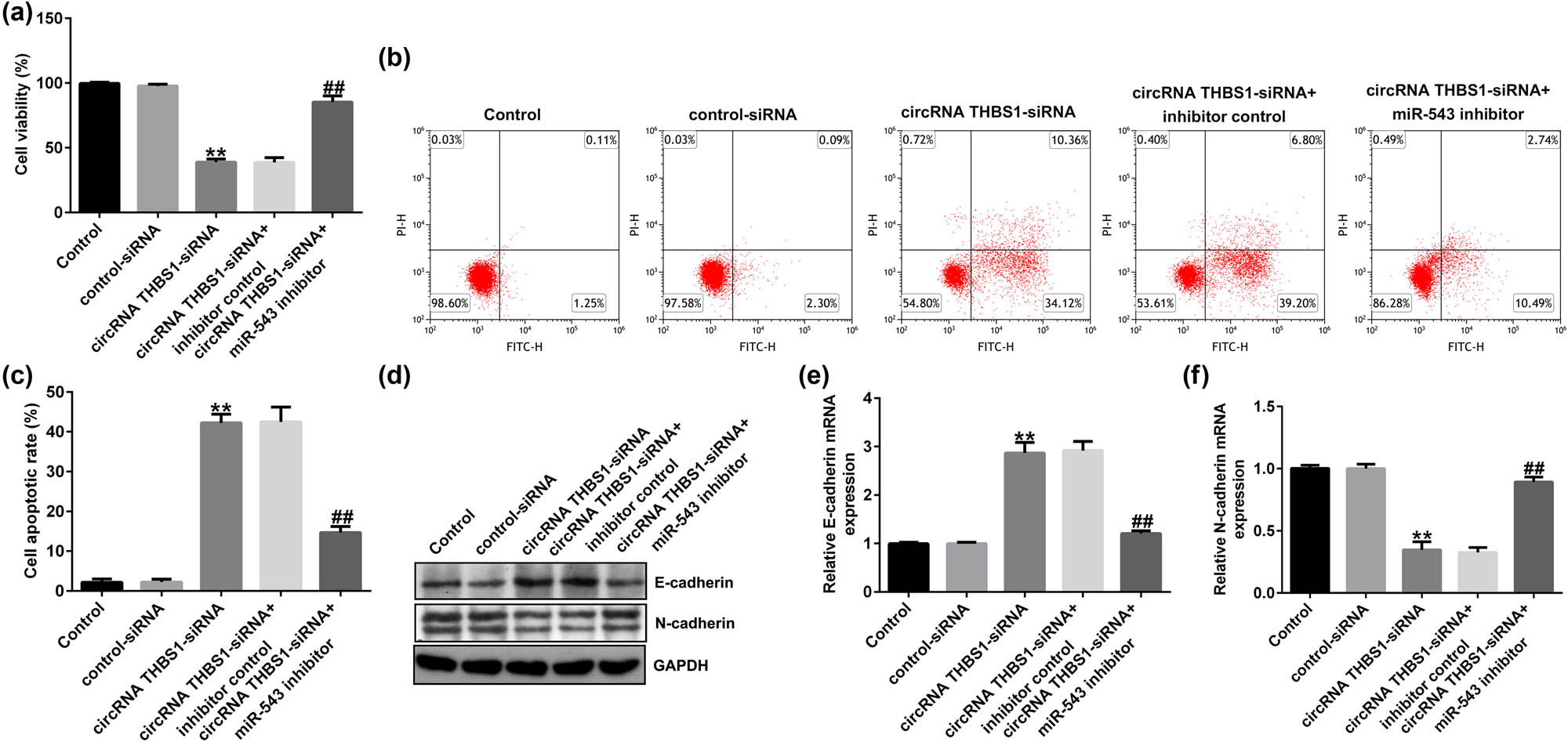 Figure 4 
                  circRNA THBS1-siRNA suppressed HeLa cells’ viability, promoted cells’ apoptosis, and inhibited EMT by sponging to miR-543. (a) Cells’ viability and (b) cell apoptosis were determined by MTT and FCM analyses. (c) Quantification of apoptotic cells. (d) Western blot analysis of E-cadherin and N-cadherin expressions. mRNA levels of E-cadherin (e) and N-cadherin (f) were checked using RT-qPCR. **P < 0.01 vs control-siRNA; ##
                     P < 0.01 vs circRNA THBS1-siRNA + inhibitor control.
               