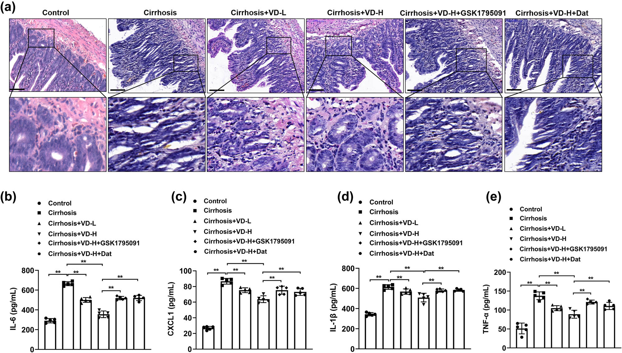 Figure 3
Vitamin D inhibited liver cirrhosis-induced intestinal pathological injury and inflammation. Vitamin D was intraperitoneally administered daily to 100 μL of vitamin D solution at different doses. The ileum tissues of each group were harvested for HE staining (a). n = 5, scale bar = 50 µm. VD-L: low-dose vitamin D group (500 IU/kg); VD-H: high-dose vitamin D group (2,000 IU/kg). The levels of inflammatory cytokines including IL-6 (b), IL-8 (c), IL-1β (d), and TNF-α (e) in the intestinal samples were determined by ELISA (n = 5). *p < 0.05, **p < 0.01 in Tukey’s post hoc comparisons test. Data are presented as mean ± SD.