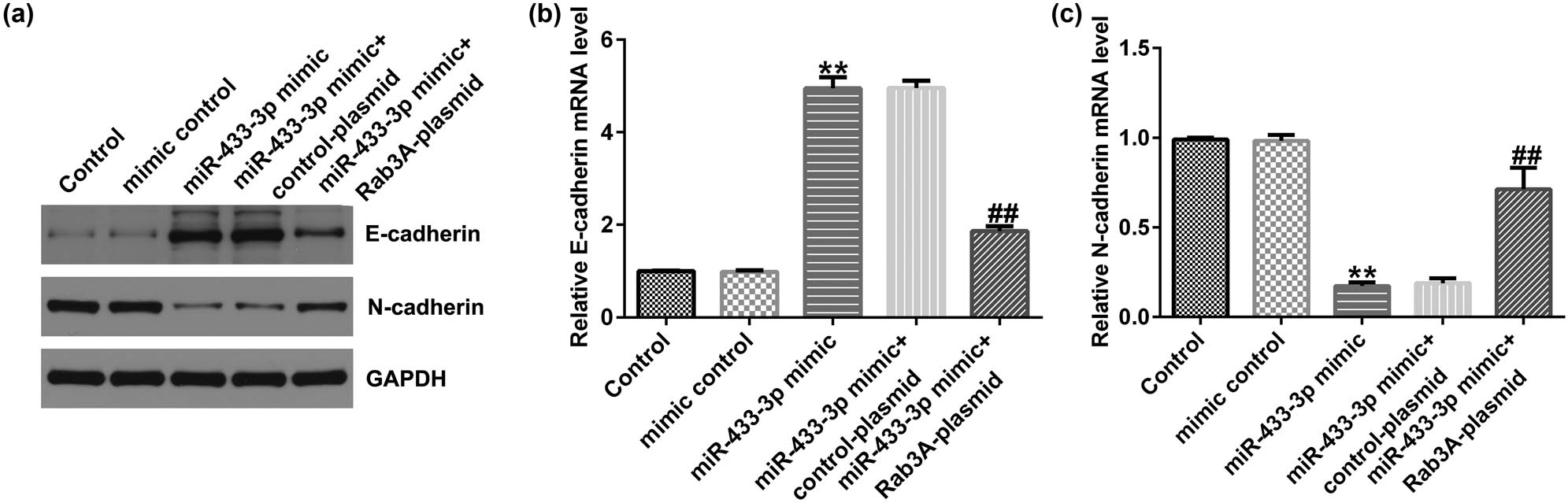 Figure 6 
                  Effects of miR-433-3p mimic or Rab3A-plasmid on A549 cells EMT. Mimic control, miR-433-3p mimic, miR-433-3p mimic + control-plasmid, or miR-433-3p mimic + Rab3A-plasmid were transfected into A549 cells for 48 h. (a) Detection of E-cadherin and N-cadherin expression using western blot assay. mRNA levels of E-cadherin (b) and N-cadherin (c) in A549 cells were checked by qRT-PCR analysis. **P < 0.01 vs mimic control; ##
                     P < 0.01 vs miR-433-3p mimic + control-plasmid.
               