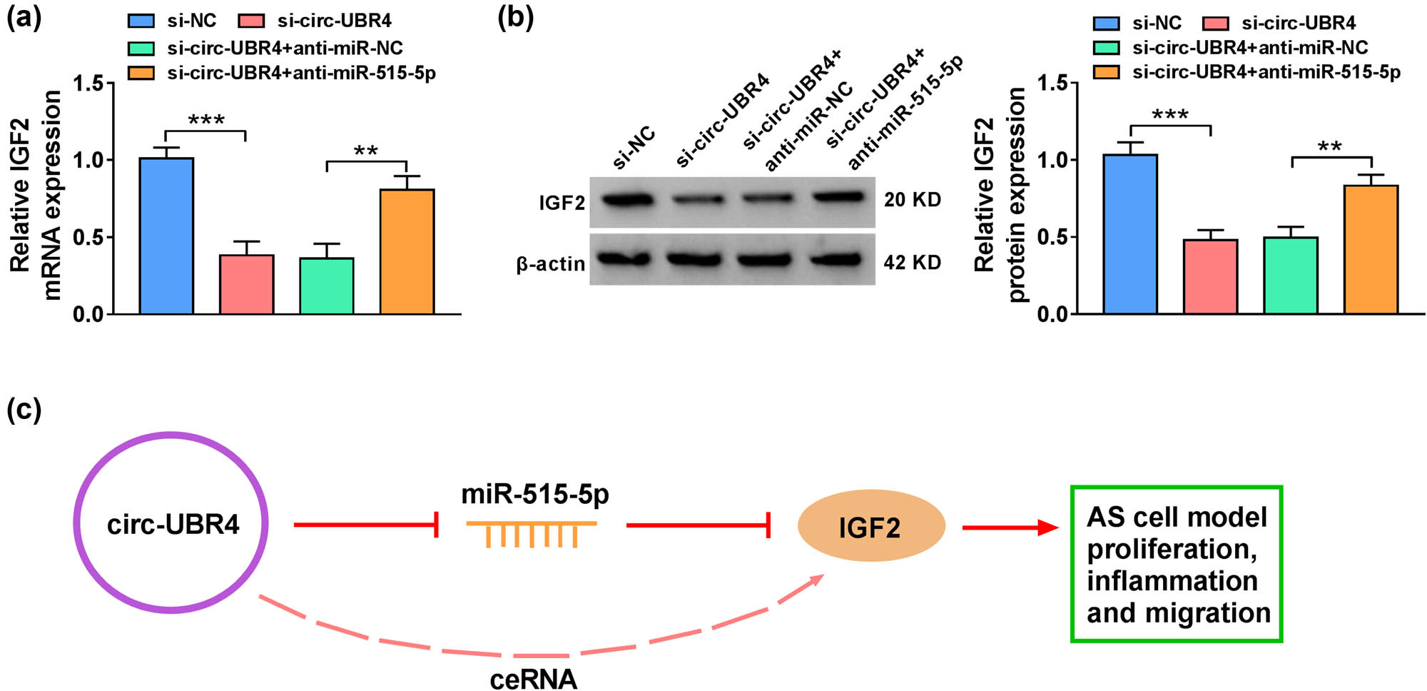 Figure 7 
                  Circ-UBR4 governed the miR-515-5p/IGF2 axis. (a) and (b) The mRNA and protein expression levels of IGF2 were measured by RT-qPCR and western blot assays in VSMCs transfected with si-NC, si-circ-UBR4, si-circ-UBR4 + anti-miR-NC, or si-circ-UBR4 + anti-miR-515-5p. (c) A model for circ-UBR4/miR-515-5p/IGF2 axis was displayed. **P < 0.01, ***P < 0.001.