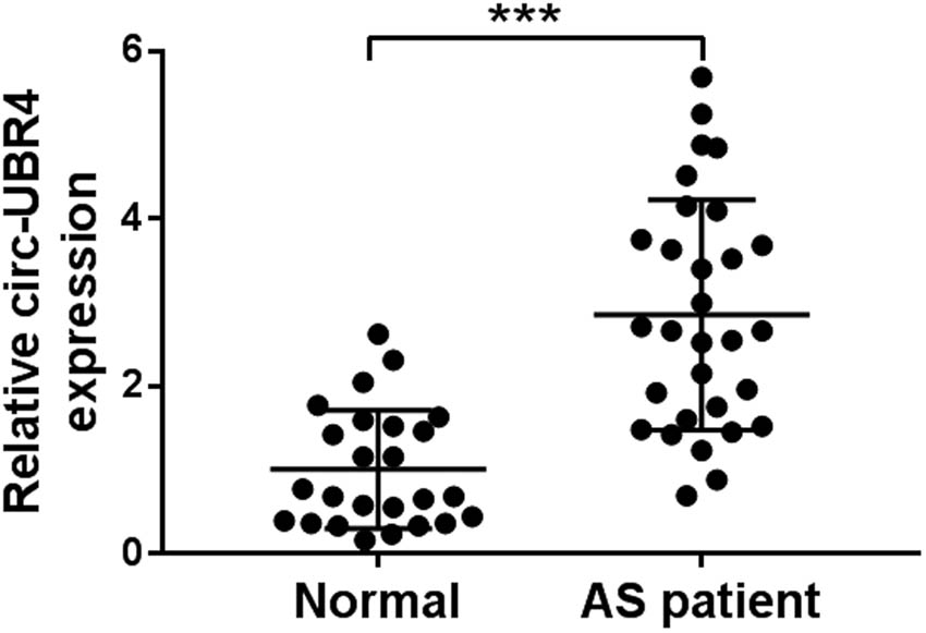 Figure A1 
                  The expression of circ-UBR4 in the serum of AS patients or healthy normal controls. RT-qPCR was used to detect the expression of circ-UBR4 in the serum of AS patients (n = 31) or healthy normal controls (n = 25). ***P < 0.001.