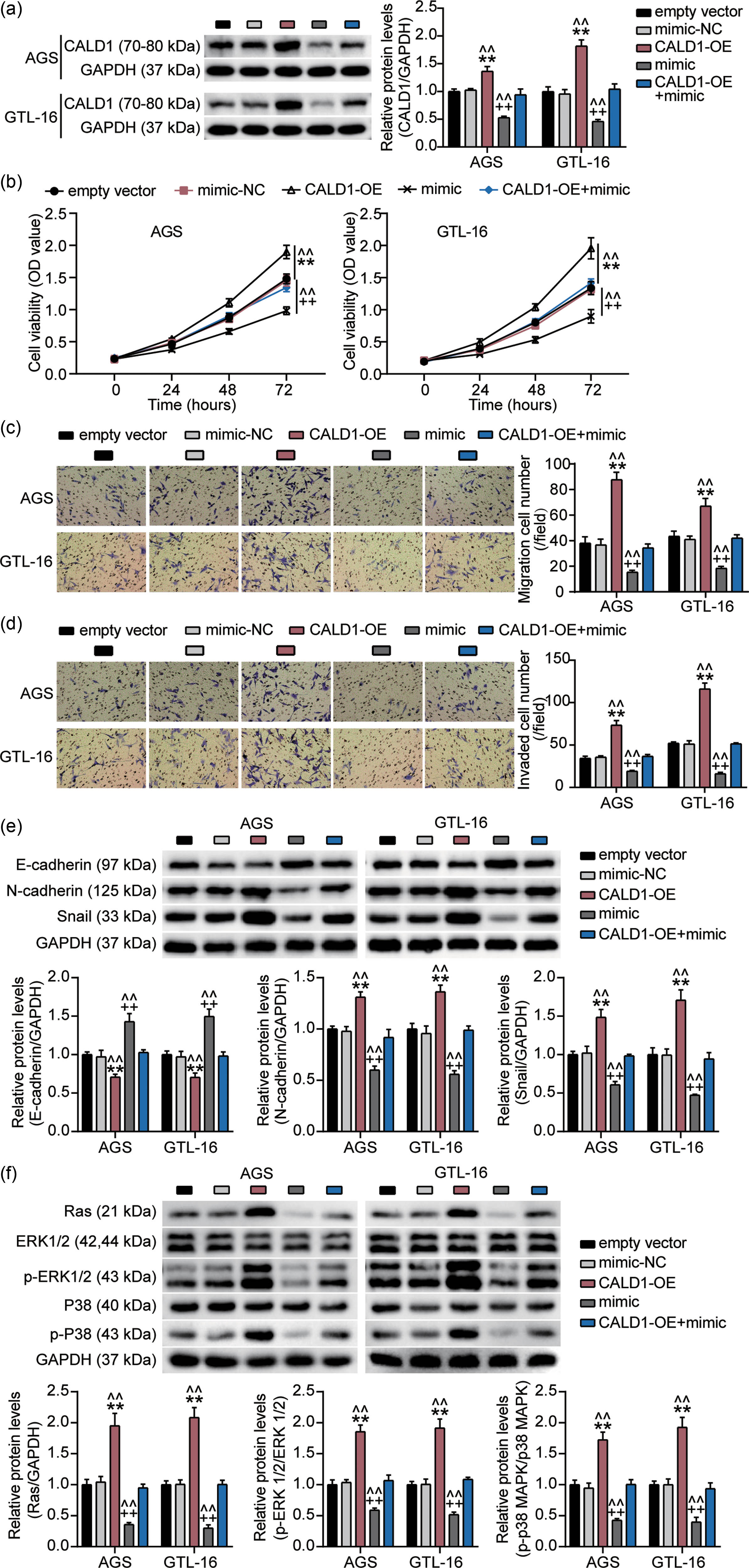 Figure 4
Restoration of CALD1 reverses the effects of miR-1278 on GC cell growth and the MAPK signaling cascade. (a) Western blotting analysis of the CALD1 protein expression in CALD1-overexpressed AGS and GTL-16 cells transfected with an miR-1278 mimic. (b) Cell viability in CALD1-overexpressed AGS and miR-1278 mimic-transfected GTL-16 cells was analyzed using a CCK-8 kit. (c and d) Cell migration and invasion in CALD1-overexpressed AGS and miR-1278 mimic-transfected GTL-16 cells were analyzed using a Transwell assay. (e) The levels of migration-related proteins (E-cadherin, N-cadherin, and Snail) in CALD1-overexpressed AGS and miR-1278 mimic-transfected GTL-16 cells were analyzed using western blotting. (f) The levels of the MAPK signaling pathway-related proteins (Ras, P38, p-P38, ERK1/2, and p-ERK1/2) in CALD1-overexpressed AGS and miR-1278 mimic-transfected GTL-16 cells were analyzed using western blotting (compared with the empty vector group, **P < 0.001; compared with the mimic-NC group, ++
P < 0.001; compared with the CALD1-OE + mimic group, ^^
P < 0.001).