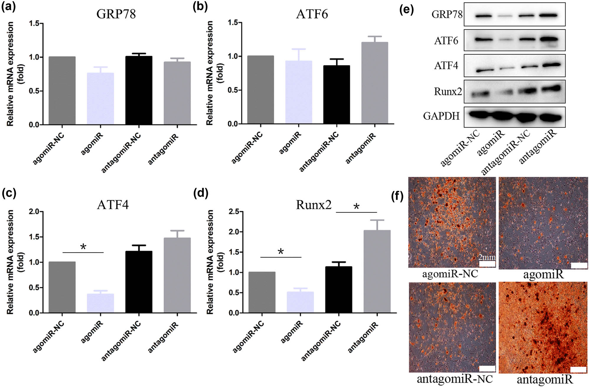 Figure 3 
                  miR-199a-5p attenuates osteoblastic differentiation of VICs in vitro. (a–d) RT-qPCR analysis of GRP78, ATF6, ATF4, and Runx2 of VICs after transfection of agomiR-199a-5p and antagomiR-199a-5p. (e) The protein levels of GRP78, ATF6, ATF4, and Runx2. (f) Representative Alizarin red staining of calcium deposition. Scale bars, 2 mm. *p < 0.05.
               