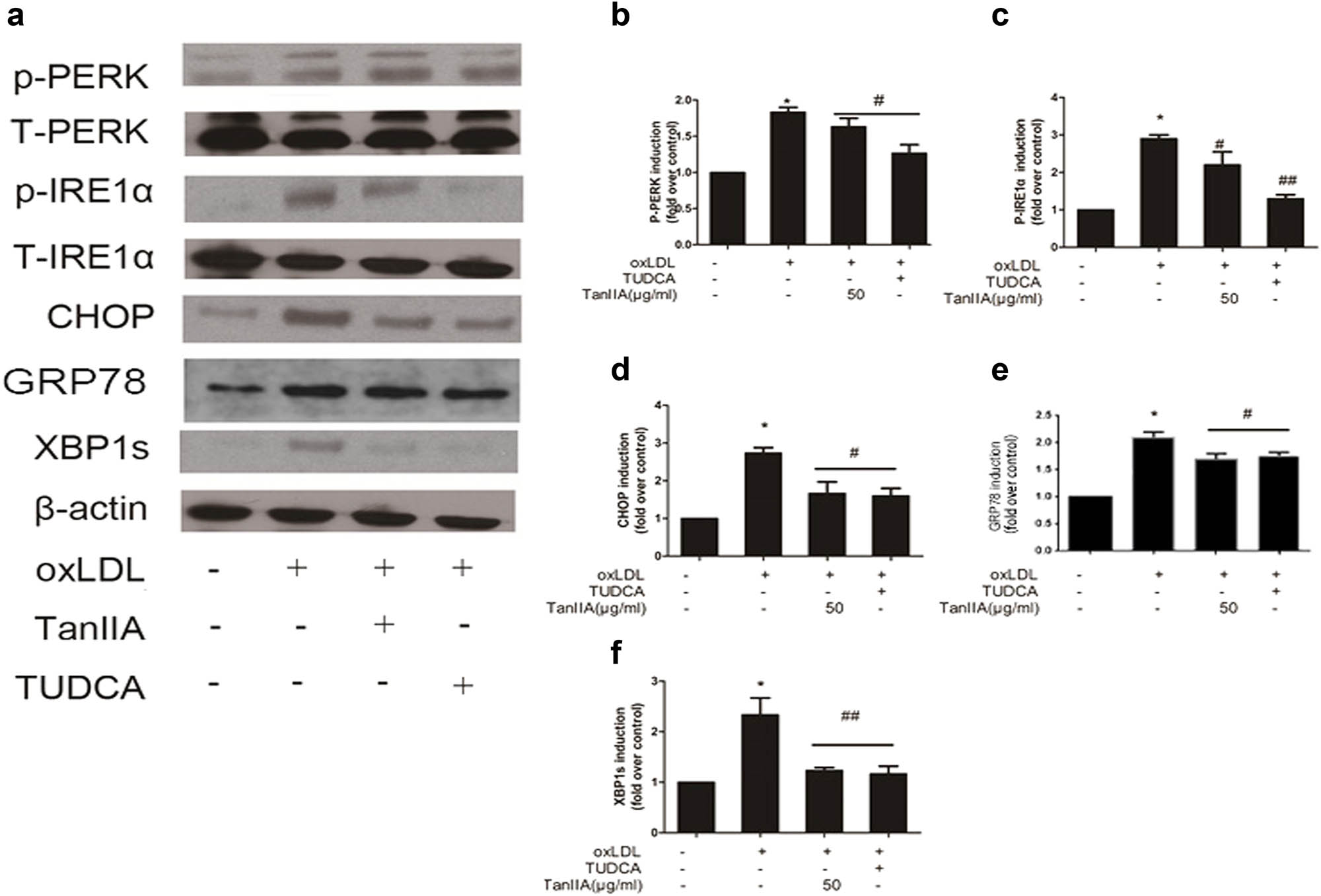 Figure 4 
                  OxLDL augmented ER stress in VICs and TanIIA reduced the effects. The augmented expression of p-PERK, p-IRE1α, GRP78, CHOP, and XBP1 were reduced by TanIIA (a) and quantitative analysis confirmed the results (b–f). (Data are presented as mean ± SD of independent experiments in cells from three different samples. *P < 0.05 vs control; #
                     P < 0.05 vs oxLDL; TUDCA: tauroursodeoxycholic acid; TanIIA: Tanshinone IIA).
               