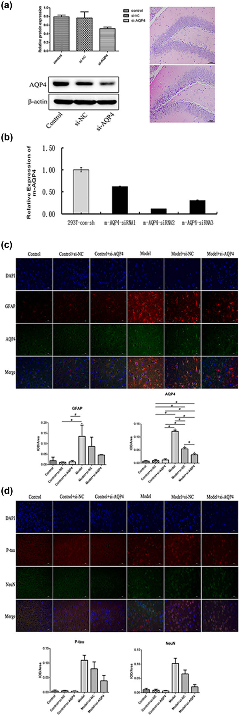 Figure 1 
                  Effects of AQP4 on GFAP and p-tau aggregation. (a and b) Histology, qPCR, and Western blot assays verify adenovirus efficiency; (c and d) GFAP and AQP4 and p-tau aggregation (pSer202/pThr205, p-tau) and neuronal marker (NeuN) co-expression were evaluated by Immunofluorescence double staining. *p < 0.05 vs control. All experiments were repeated 3 times. Each group has 7 mice.
               