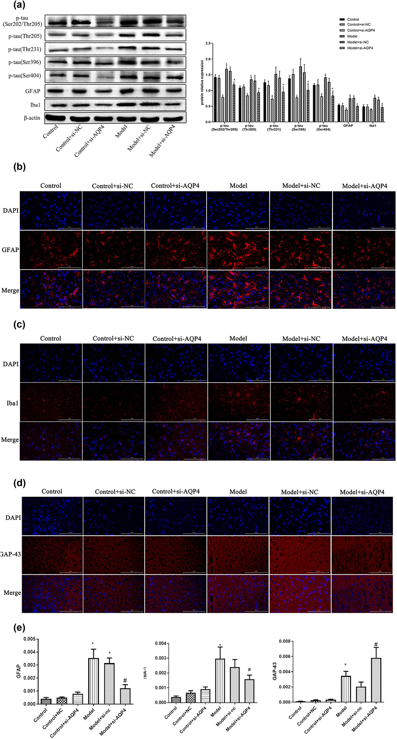 Figure 3 
                     Effects of AQP4 on astrocytes, microglia, and neurodegeneration. (a) The expression of p-tau (Ser202/Thr205, Thr205, Thr231, Ser396, Ser404) and Iba1 in brain tissue was detected by Western blot. (b–e) GFAP, iba1 and GAP43 were detected by Immunofluorescence double staining and analyzed results were obtained (e). *p < 0.05 vs control, #
                        p < 0.05 vs model. All experiments were repeated 3 times. Each group has 7 mice.
                  