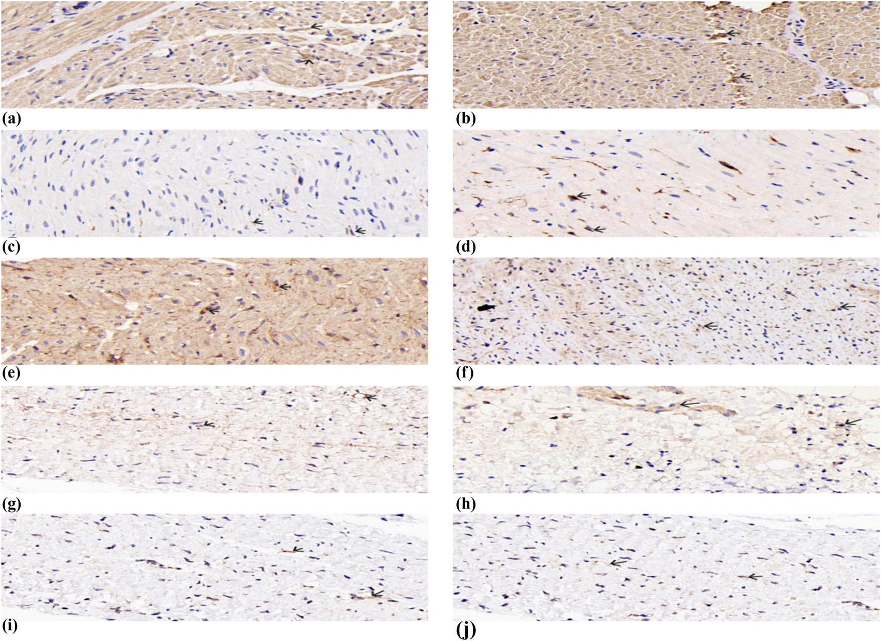 Figure 3 
                     Localization of ET-1 (a and b), NGF (c and d), p75NTR (e and f), NF-κB p65 (g and h), and TH (i and j) in the atrial tissue was determined by immunohistochemistry. Scale bar represents 50 μm.
                  
