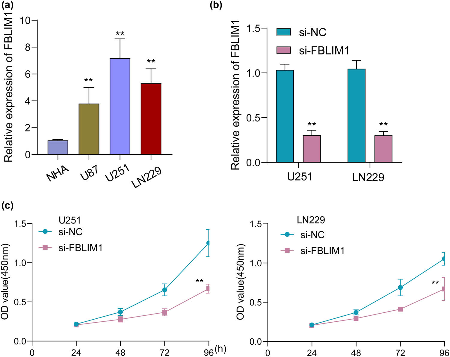 Figure 8
FBLIM1 knockdown suppressed glioma cell proliferation. (a) RT-PCR was applied to examine FBLIM1 levels in three glioma cells and NHA cells. (b) FBLIM1 expression was decreased in glioma after the transfection of si-FBLIM1. (c) CCK-8 analysis was employed for elucidating the function of FBLIM1 knockdown on U251 and LN229 cell proliferation.