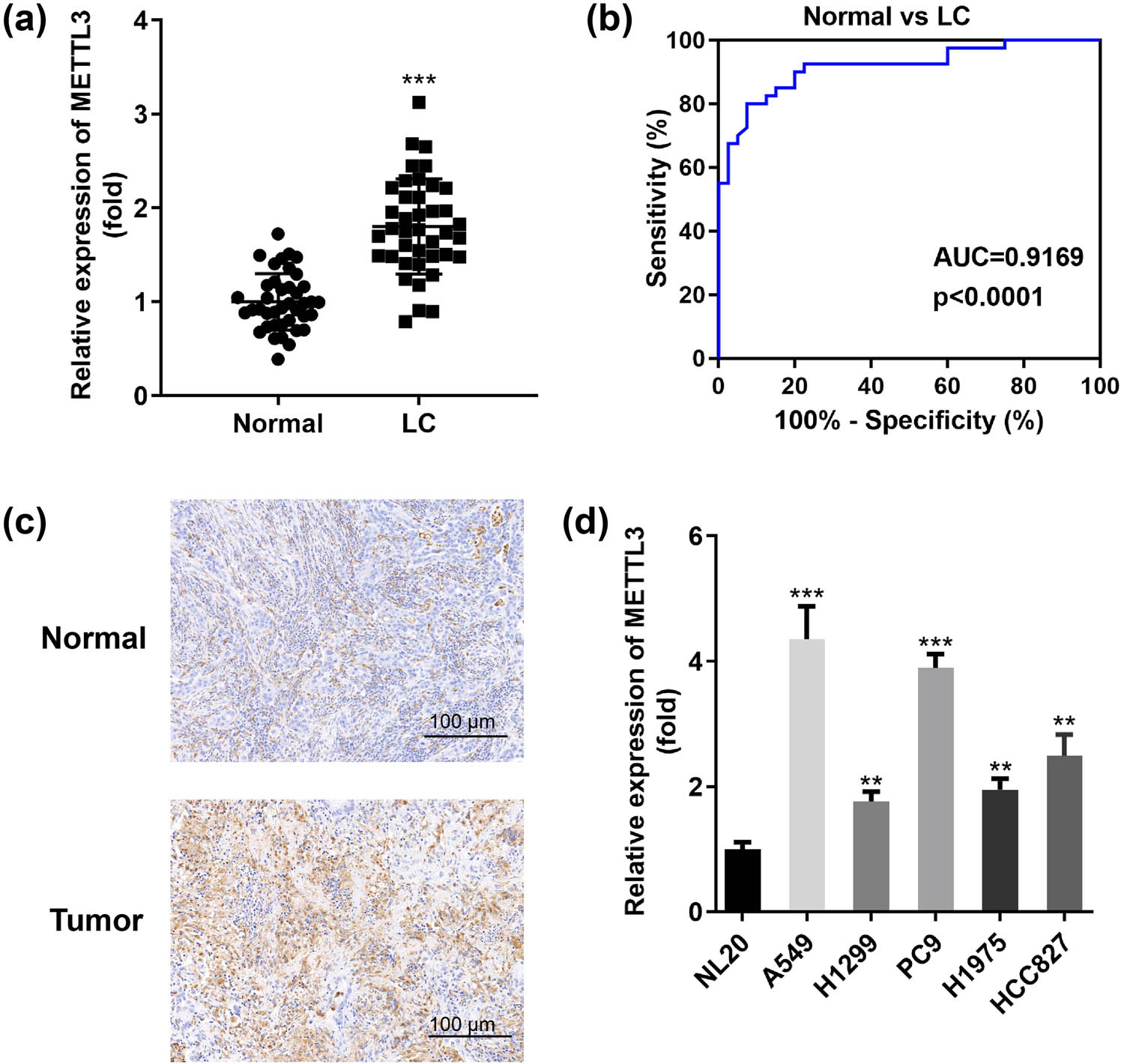 Figure 1
METTL3 exists in LC tumors in an overexpression pattern and is a promising biomarker for LC patients. (a) RT-qPCR assay was applied to show METTL3 expression in 40 pairs of collected clinical LC tumor tissues and paired normal tissues (Normal). (b) ROC curves were established to assess the potential diagnostic value of METTL3 based on its expression in tumor samples. (c) Typical IHC images of METTL3 staining in paired LC tumor tissues. Scale bar, 100 μm. (d) Differences in METTL3 expression levels between human bronchial epithelial cells (NL20) and representative LC cells (A549, H1299, PC9, H1975, and HCC827). **P < 0.01, ***P < 0.001.