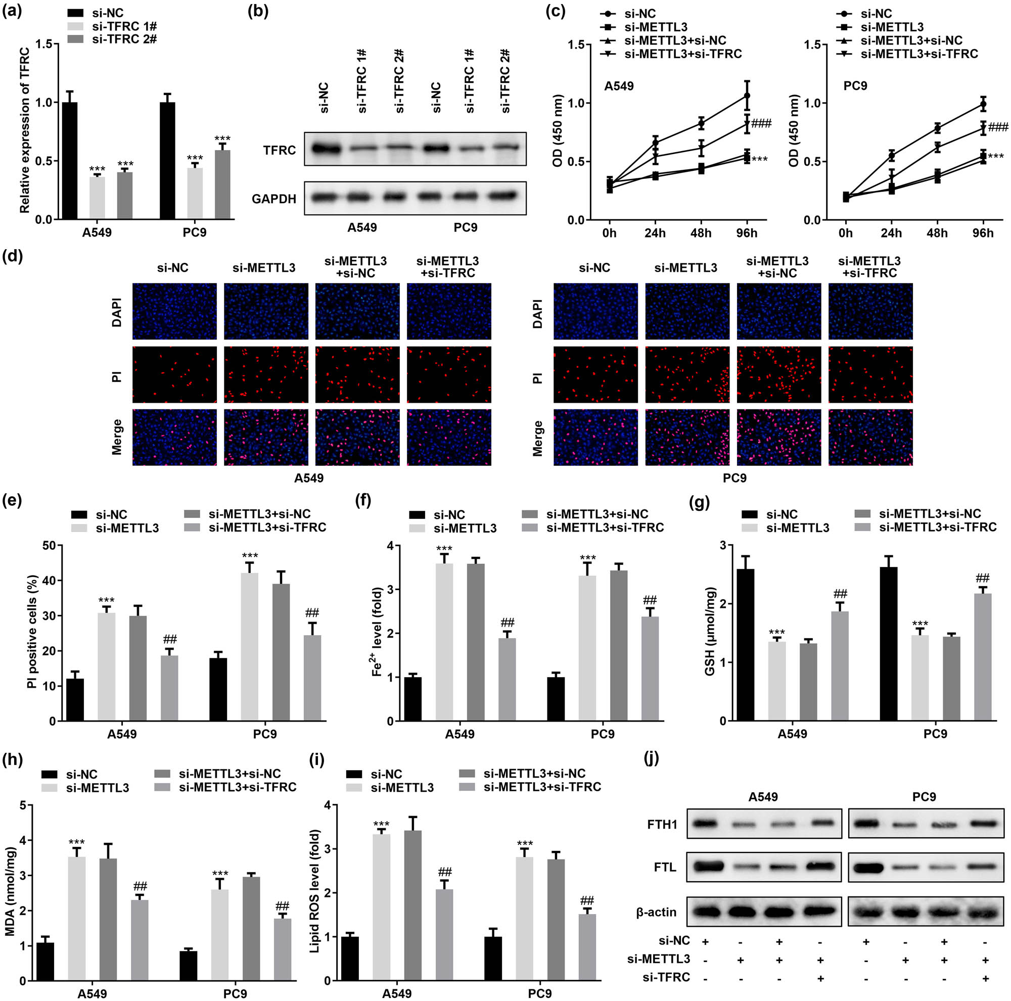 Figure 5
METTL3 knockdown-induced ferroptosis is limited by the decreased TFRC expression levels in LC cells. A549 and PC9 cells were transfected with si-NC, si-METTL3, si-METTL3 + si-NC, and si-METTL3 + si-TFRC, respectively. (a and b) RT-qPCR and western blot was employed to verify the knockdown efficiency of si-TFRC 1# and si-TFRC 2# in A549 and PC9 cells. (b) CCK-8 assay was performed to detect the effect of TFRC silencing on the viability of METTL3-knockdown A549 and PC9 cells. (c and d) DAPI/PI staining was used to verify the effect of TFRC silencing on the death of METTL3-knockdown A549 and PC9 cells. (f–i) Concentrations of Fe2+, GSH, MDA, and lipid ROS in A549 and PC9 cells were evaluated after co-transfection of si-TFRC and si-METTL3. (j) Protein expression of FTH1 and FTL in A549 and PC9 cells co-transfected with si-TFRC and si-METTL3 was measured by western blotting. ##
P < 0.01, ###
P < 0.001, ***P < 0.001.