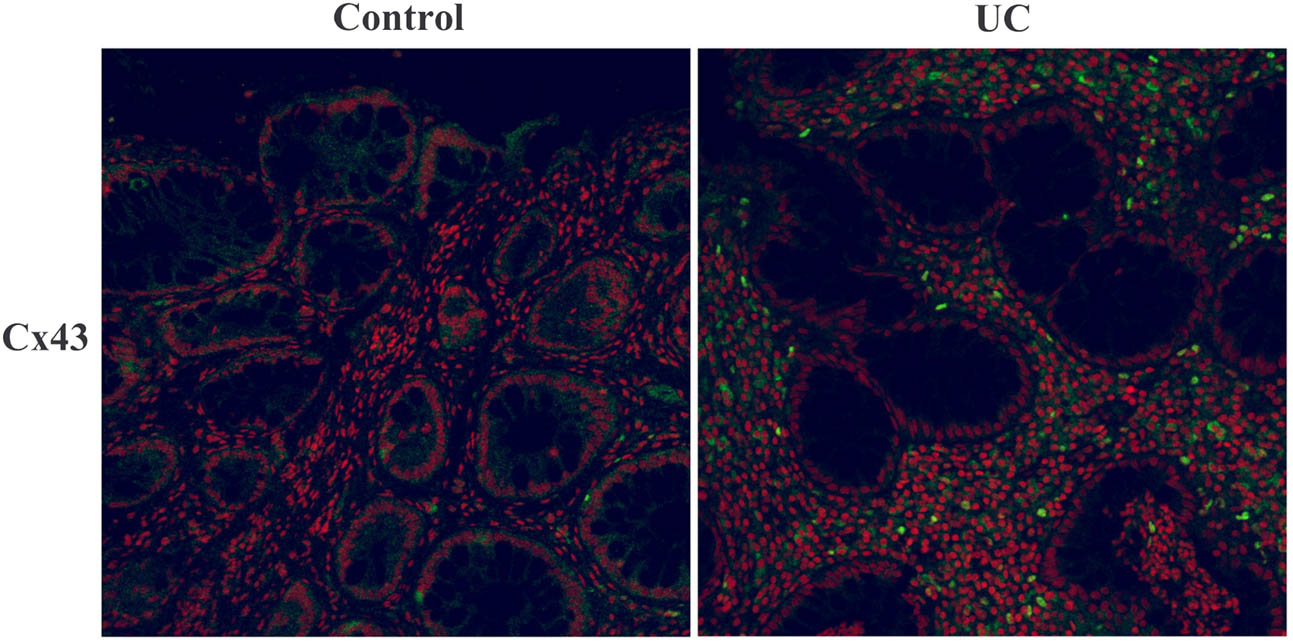 Figure 3
Immunofluorescence analysis of Cx43 expression and distribution (400×).