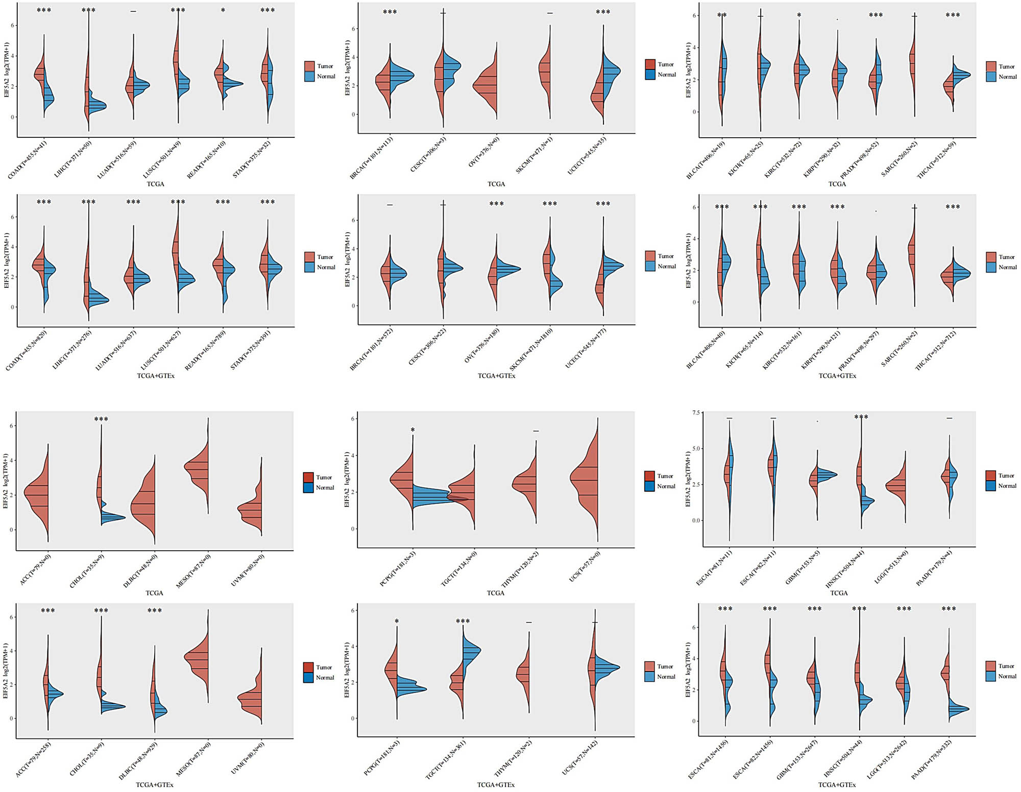 Figure 9
EIF5A2 expression in different types of cancers. The expression distribution of EIF5A2 in tumor tissues and normal tissues. The abscissa represents different tumor tissues, the ordinate represents the expression distribution of EIF5A2, and different colors represent different groups. *p< 0.05, **p< 0.01,***p< 0.001, asterisks (*) stand for significance levels. The statistical difference of two groups was compared through the Wilcox test. ACC: adrenocortical carcinoma; BLCA: bladder urothelial carcinoma; BRCA: breast invasive carcinoma; CESC: cervical squamous cell carcinoma and endocervical adenocarcinoma; CHOL: cholangiocarcinoma; COAD: colon adenocarcinoma; ESCA: esophageal carcinoma; GBM: glioblastoma multiforme; HNSC: head and neck squamous cell carcinoma; KICH: kidney chromophobe; KIRC: kidney renal clear cell carcinoma; KIRP: kidney renal papillary cell carcinoma; LGG: brain lower-grade glioma; LIHC: liver hepatocellular carcinoma; LUAD: lung adenocarcinoma; LUSC: lung squamous cell carcinoma; MESO: mesothelioma; OV: ovarian serous cystadenocarcinoma; PAAD: pancreatic adenocarcinoma; PCPG: pheochromocytoma and paraganglioma; PRAD: prostate adenocarcinoma; READ: rectum adenocarcinoma; SARC: sarcoma; SKCM: skin cutaneous melanoma; STAD: stomach adenocarcinoma; TGCT: testicular germ cell tumors; THCA: thyroid carcinoma; THYM: thymoma; UCEC: uterine corpus endometrial carcinoma; UCS: uterine carcinosarcoma; UVM: uveal melanoma.