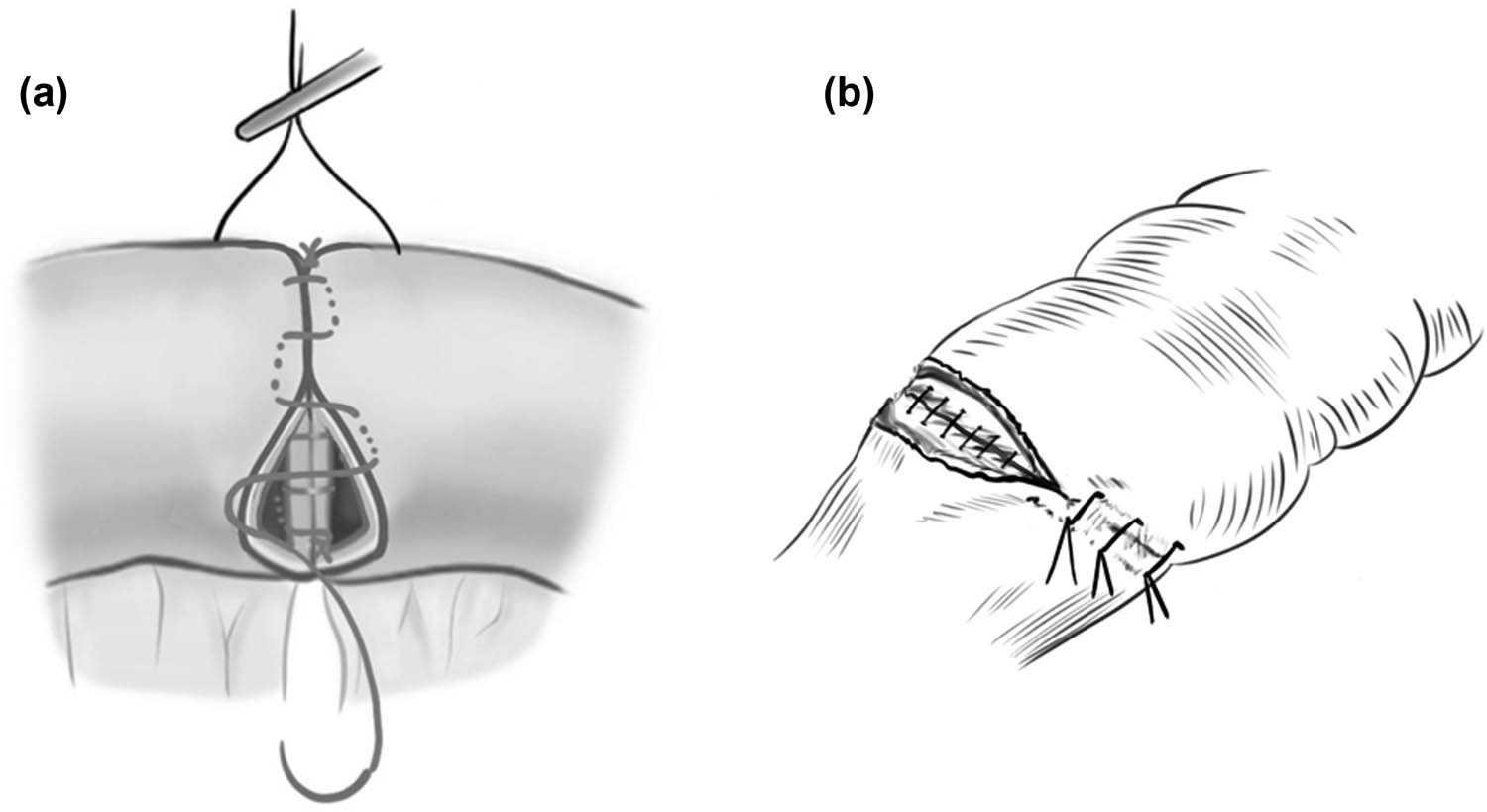 Teaser image from the article