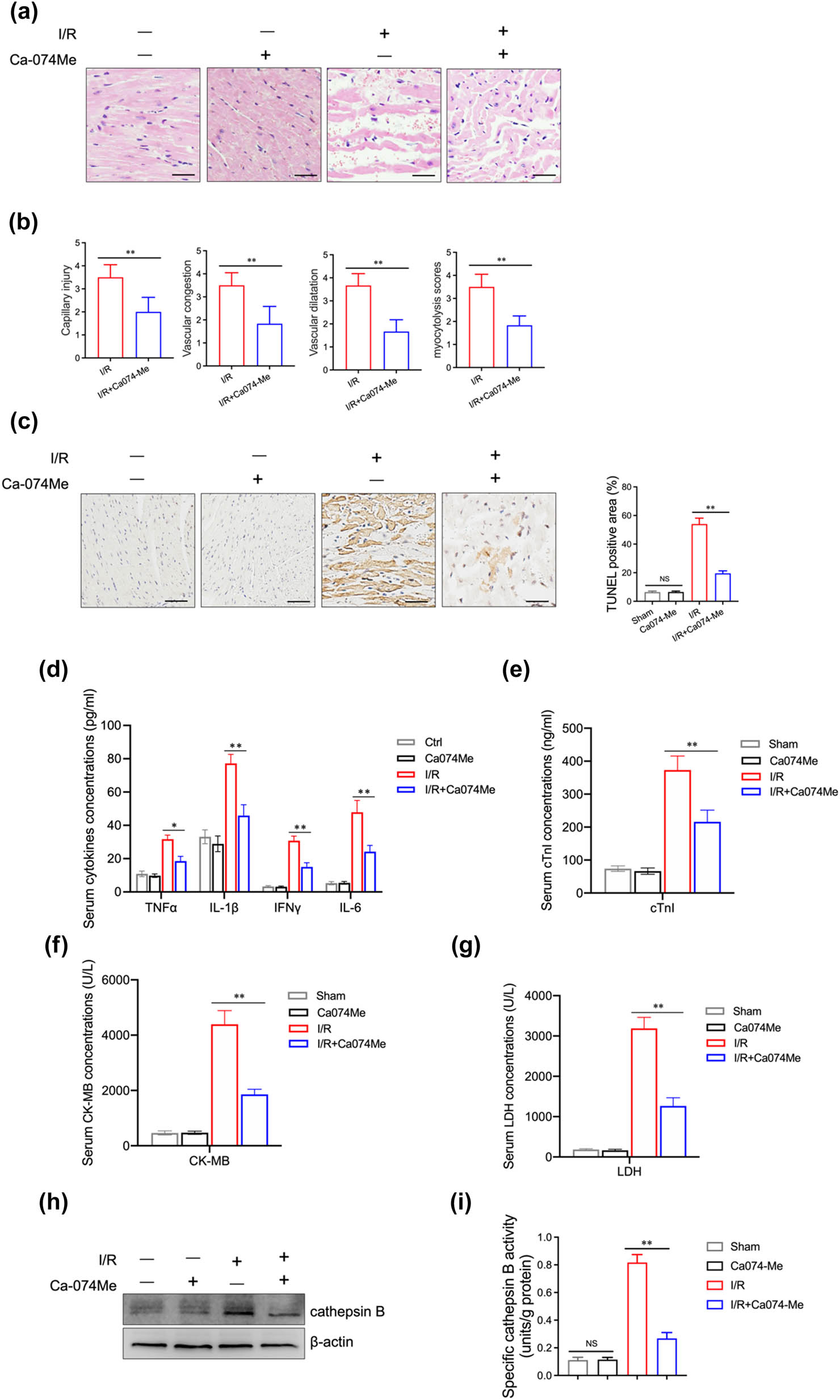 Figure 2
Effects of cathepsin B inhibitor on myocardial injury in myocardial I/R mice. Myocardial ischemia/reperfusion surgery and intraperitoneal injections of Ca-074 Me (50 mg/kg) were simultaneously used to treat mice (n = 6 per group). (a) The histological analysis of the mouse heart on day 1 after surgery was performed by H&E. (b) Capillary injury, vascular congestion, vascular dilatation, and myocytolysis scores of myocardial injury were evaluated. (c) Cell death in the mouse heart tissue was examined by TUNEL staining. Scale bar = 100 μm. (d) The expression level of inflammatory cytokines (TNF-α, IL-1β, IFN-γ, IL-6) in serum was measured by ELISA. The levels of cTnl (e), CK-MB (f), and LDH (g) were detected by ELISA. The protein level (h) and the activity (i) of cathepsin B were evaluated by western blotting analysis and ELISA, respectively. *p < 0.05 and **p < 0.01. Data are representative of three independent experiments with similar results.