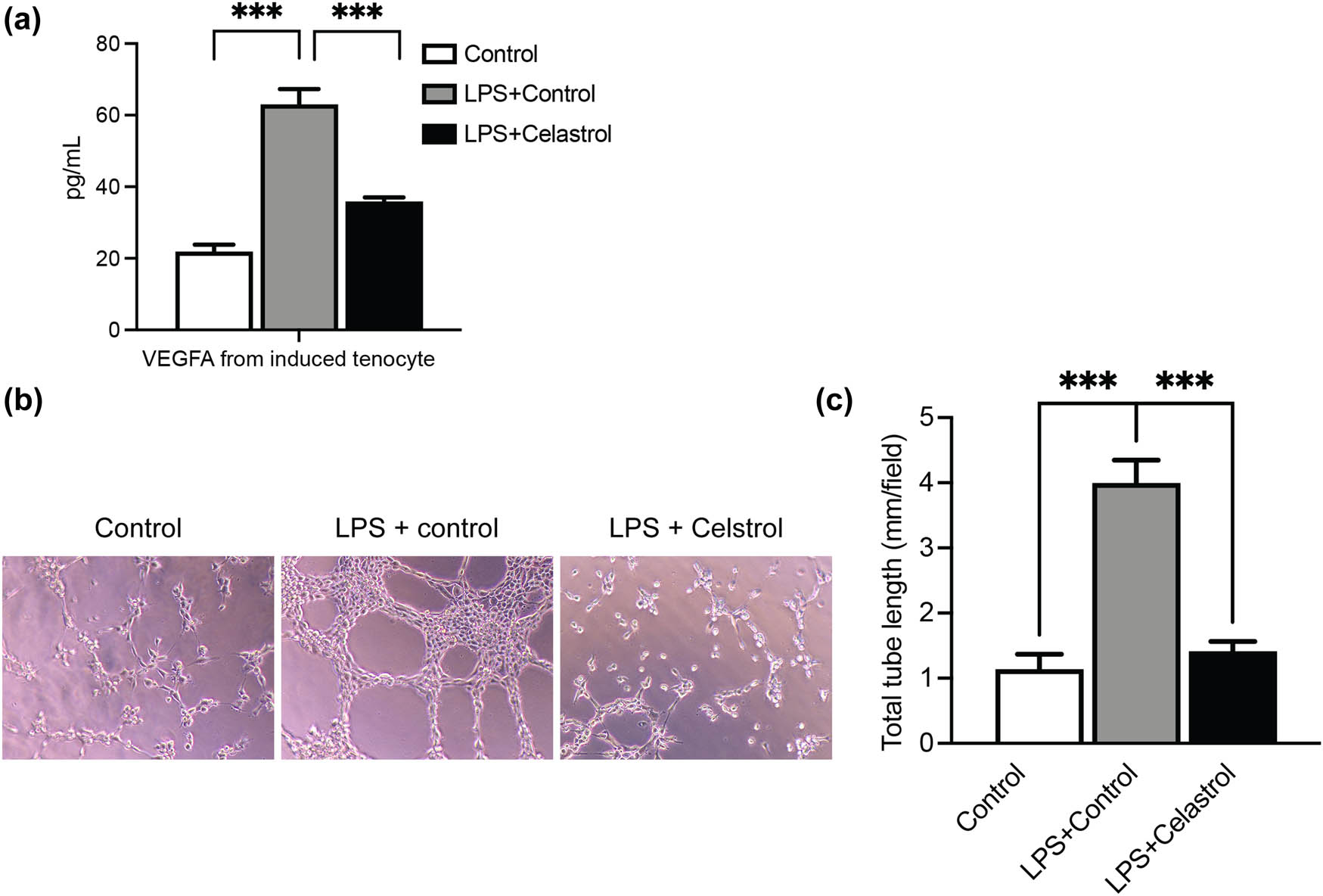 Figure 3
Celastrol suppresses angiogenesis by inflammatory tenocytes. (a) LPS-induced tenocytes were treated with or without celastrol, and then the secreted levels of VEGFA from the culture medium were determined. (b) and (c) RAOEC cells were administered conditioned medium from tenocytes with the indicated treatments. Then the angiogenesis assay was conducted. Scale bar, 100 μm. Data are shown as mean ± SD from three repeated experiments (n = 3). ***denotes P < 0.001.