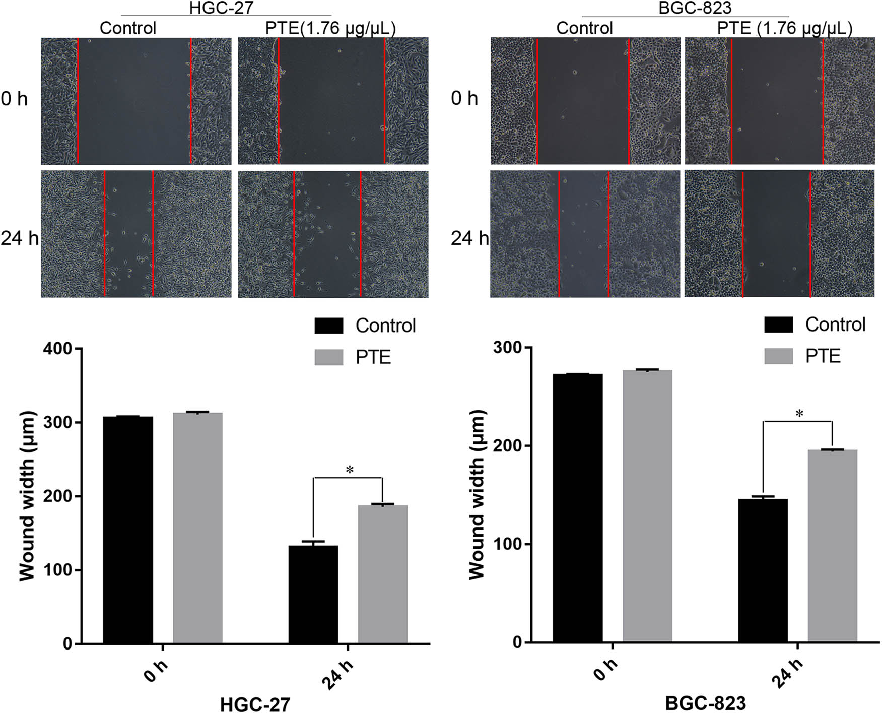 Figure 3
Effects of PTE on the migration of HGC-27 and BGC-823 cells. * represents p < 0.05 compared with the control group.