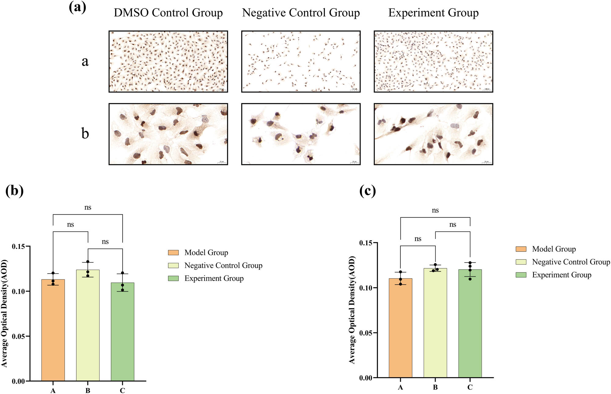 Figure 9 
                  ICC staining and DAB color development results for PSA expression are displayed in (a), with brown granules indicating positive expression. ((a) includes low-magnification (×100) images, while (b) includes high-magnification (×400) images). The statistical analysis of the AOD data for PSA expression under low magnification is shown in (b), and under high magnification in (c). The numerical details can be seen in Figure 10c(e) and (f).
               