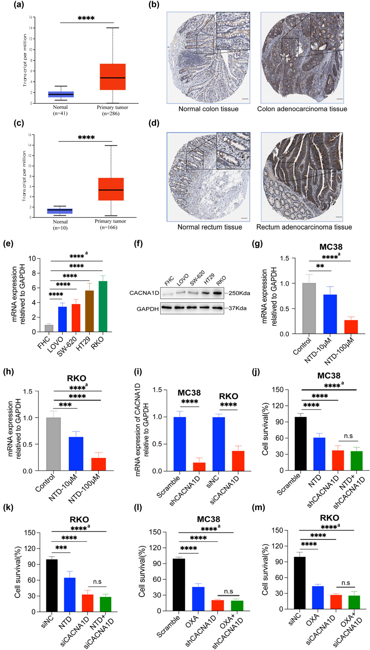 Figure 3
NTD inhibited CRC progression and enhanced OXA therapeutic effect in vitro by downregulating CACNA1D. (a) Data from the GEO were utilized to analyze CACNA1D expression in colon tumor tissues. (b) IHC detection data of CACNA1D expression in colon tumor tissues downloaded from the HPA database (www.proteinatlas.org), scale bar, 100 μm. (c) Data from the GEO were utilized to analyze the CACNA1D expression in rectum tumor tissues. (d) IHC detection data of CACNA1D expression in rectum tumor tissues downloaded from the HPA database (www.proteinatlas.org), scale bar, 100 μm. (e) qPCR detection of CACNA1D expression of FHC and CRC cell lines. (f) WB detection of CACNA1D expression of FHC and CRC cell lines. (g) qPCR detection of CACNA1D expression in MC38 after NTD treatment. (h) qPCR detection of CACNA1D expression in RKO after NTD treatment. (i) The efficiency of CACNA1D knockdown in MC38 and RKO was examined by qPCR assay. (j) Cell viability of MC38 after CACNA1D knockdown and with the addition of NTD (100 μM) for 48 h. (k) Cell viability of RKO after knocking down CACNA1D and being treated by NTD (100 μM) for 48 h. (l) Cell viability of MC38 after CACNA1D knockdown and upon with the addition of OXA (20 μM) for 48 h. (m) Cell viability of RKO after CACNA1D knockdown and treated by OXA (20 μM) for 48 h. a, analysis of variance performed between multiple groups.