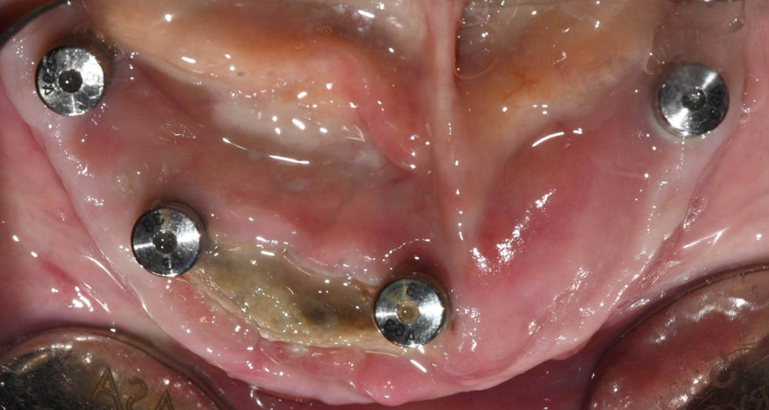 Teaser image from the article