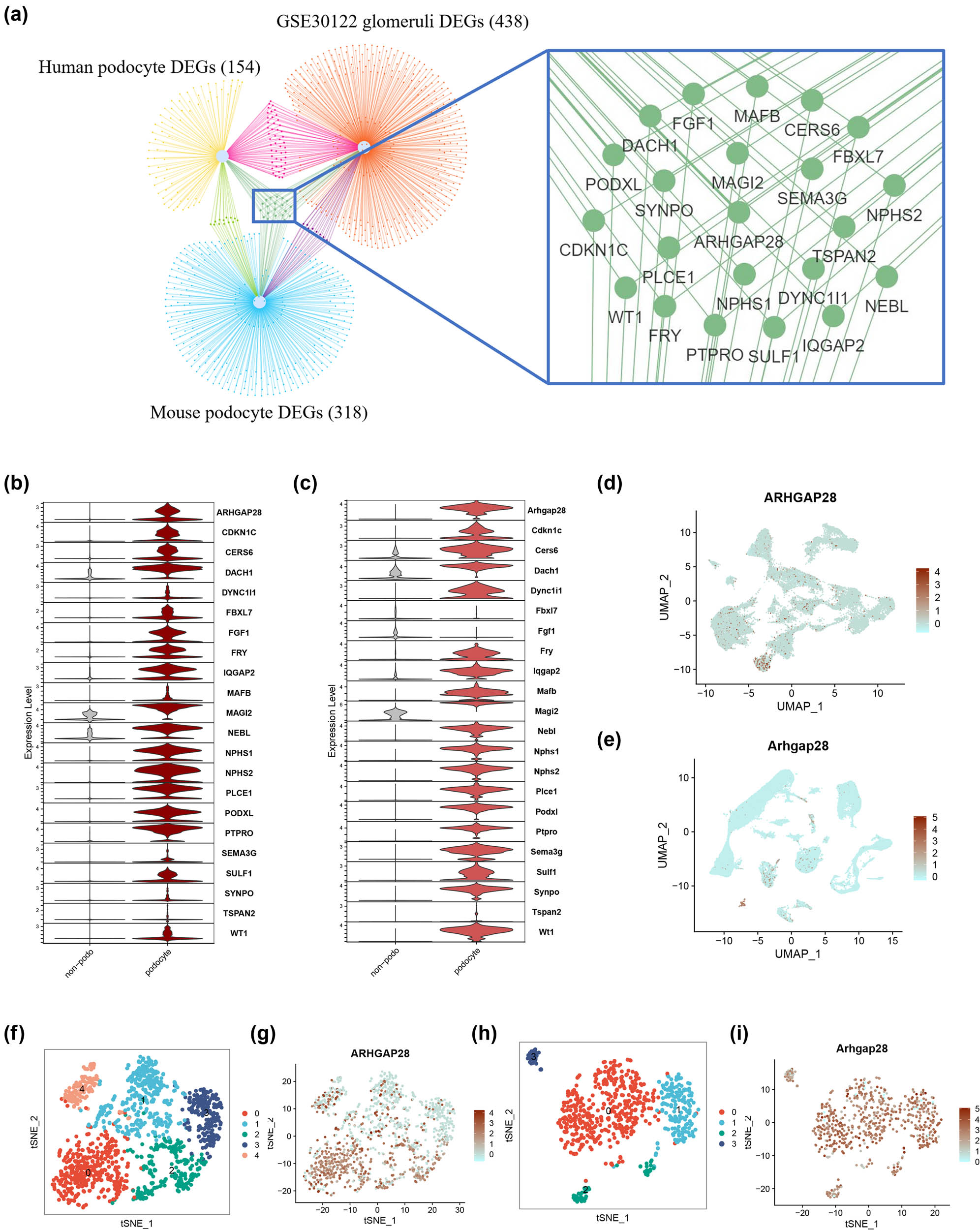 Figure 4 
                  Narrow down target genes and ARHGAP28 expression in single-cell data. (a) Overlap between DEGs of human podocytes, human orthologs of DEGs of mouse podocytes, and diabetic kidney glomeruli DEGs. (b) Expression of 22 overlap genes in human single-cell data (violin plot); all cells are grouped into podocytes and non-podocytes. (c) Expression of 22 overlap genes in mouse single-cell data (violin plot); all cells are grouped into podocytes and non-podocytes. (d) Expression of ARHGP28 in human single cell data (feature plot). (e) Expression of ARHGAP28 in mouse single cell data (feature plot). (f) Sub-clusters of human podocytes. (g) Expression of ARHGAP28 in human podocyte sub-clusters (feature plot). (h) Sub-clusters of mouse podocytes. (i) Expression of ARHGAP28 in mouse podocyte sub-clusters (feature plot).
               