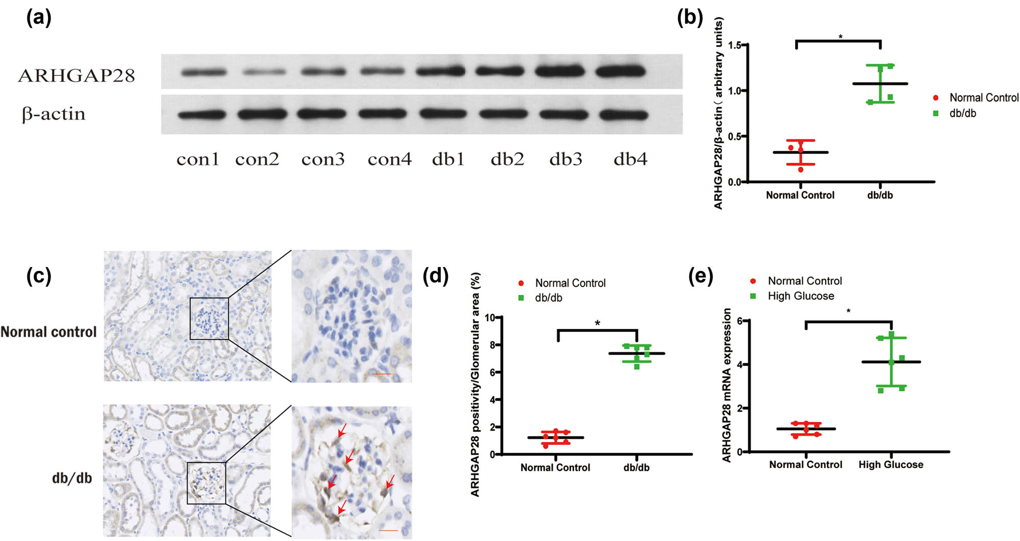 Figure 6 
                  Validation of ARHGAP28 in DKD. (a) Western blot gel showing ARHGAP28 protein expression in the mouse kidney cortex. (b) Semiquantitative analysis of ARHGAP28 protein expression in the mouse kidney cortex. (c) Images of glomerular ARHGAP28 immunohistochemical staining from mouse kidney sections. (d) Semi-quantitative analysis of ARHGAP28 immunohistochemical staining from mouse kidney sections. *P < 0.05. Scale bar = 25 µm. Red arrows indicate the positive staining of ARHGAP28. (e) Podocytes were cultured in vitro and stimulated by high glucose. Expression of mRNA of ARHGAP28 in the treated group and normal control group was tested by qPCR. *P < 0.05.
               