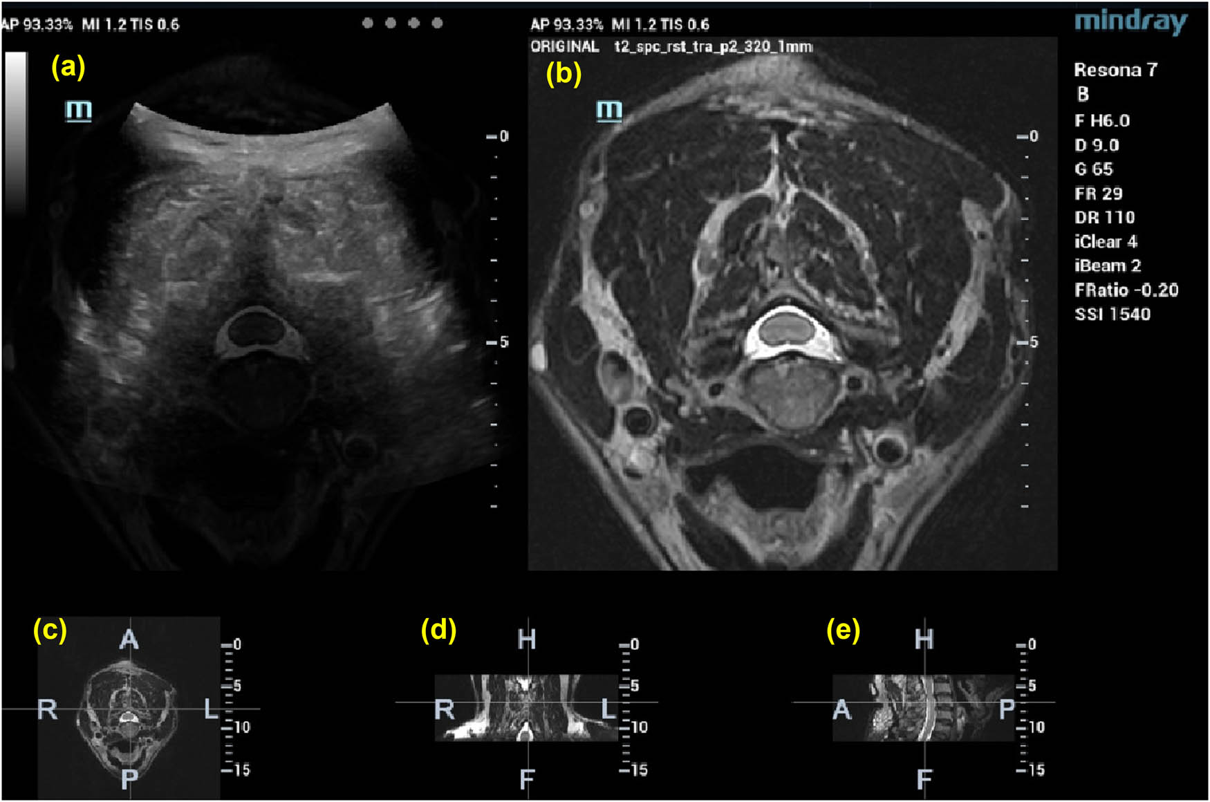Teaser image from the article
