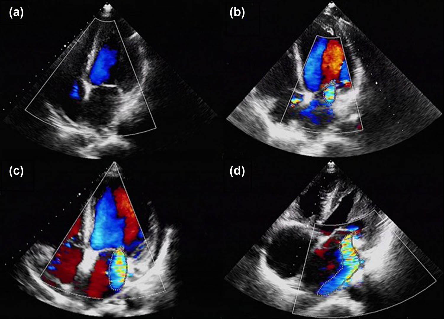 Teaser image from the article