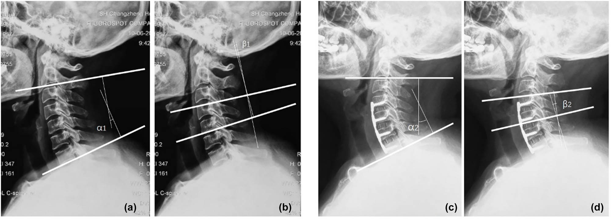 Teaser image from the article