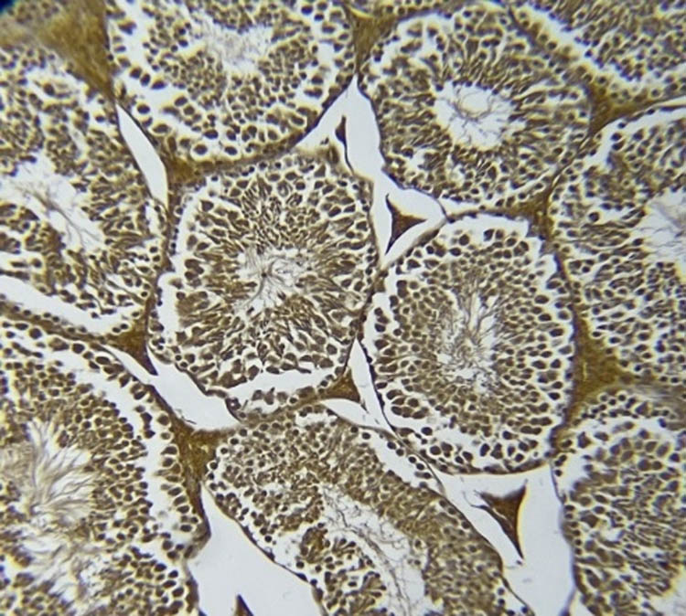 Figure 8 
                  NOS immunoreactivity in the diabetic C. gileadensis sap-treated group.
               
