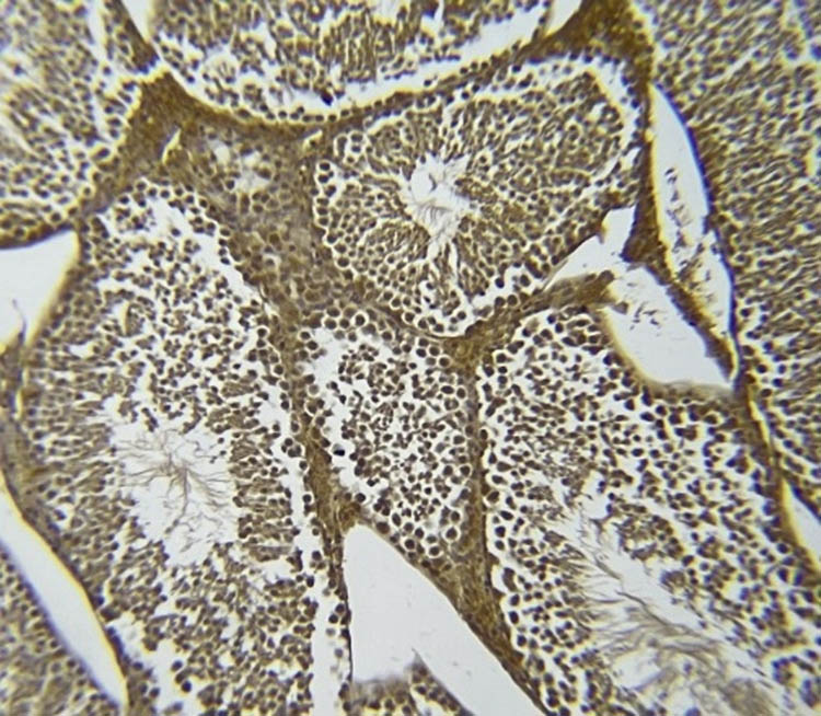 Figure 9 
                  NOS immunoreactivity in the diabetic C. gileadensis methanol-treated group.
               