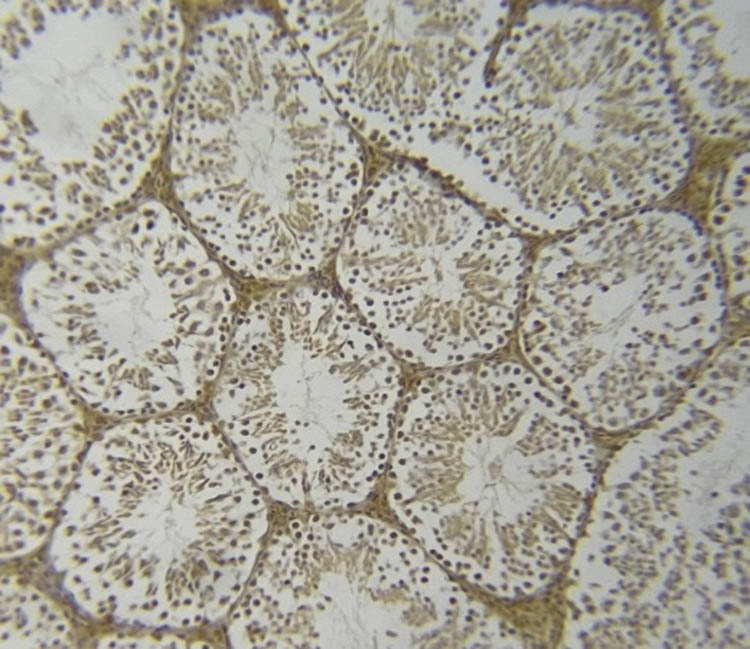 Figure 10 
                  NOS immunoreactivity in the diabetic C. gileadensis acetone-treated group.
               