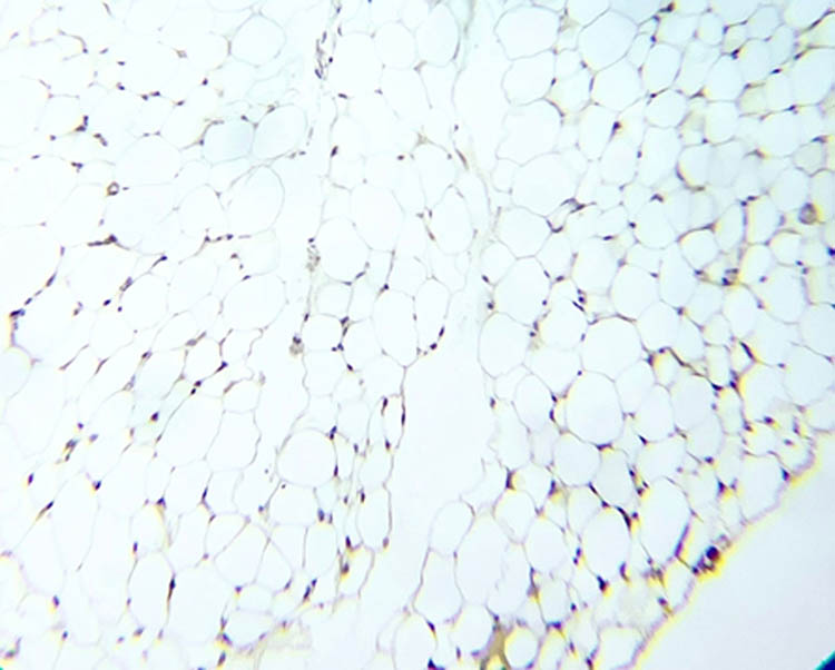 Figure 11 
                  NOS immunoreactivity in the untreated diabetic group.
               