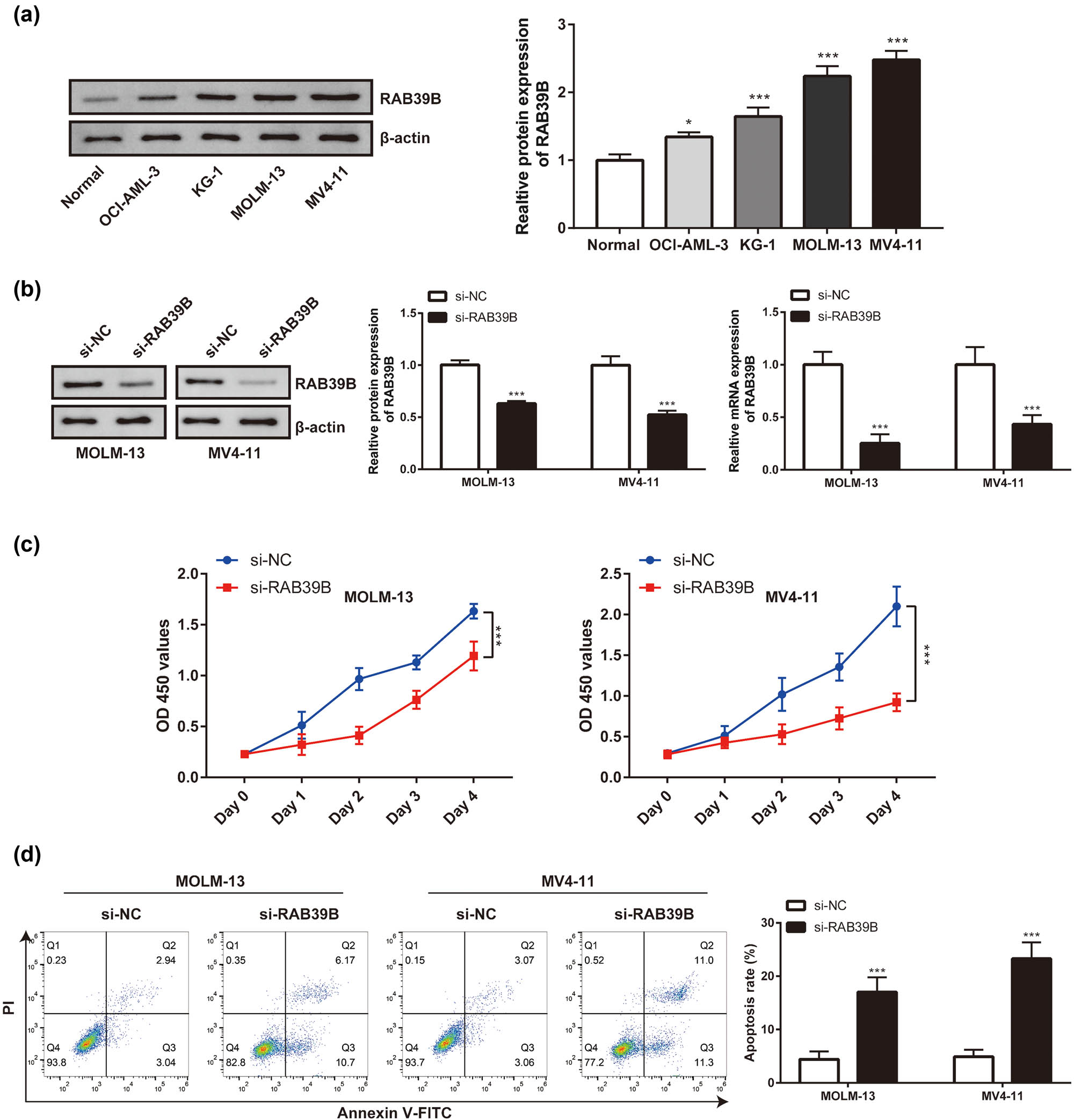 Figure 10
AML is linked to the expression and proliferation of RAB39B in cells. (a) The expression of RAB39B in various cell lines was detected using Western blotting and qPCR. (b) qPCR and Western blotting techniques were used to measure the transfection effectiveness of RAB39B siRNA in MOML-13 and MV4-11 cells. (c) The CCK-8 proliferation experiment revealed that suppressing RAB39B can result in reduced AML cell proliferation. (d) Knocking down RAB39B leads to increased apoptosis in AML cells.
