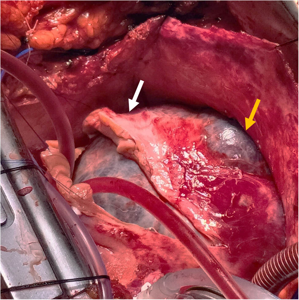 Teaser image from the article