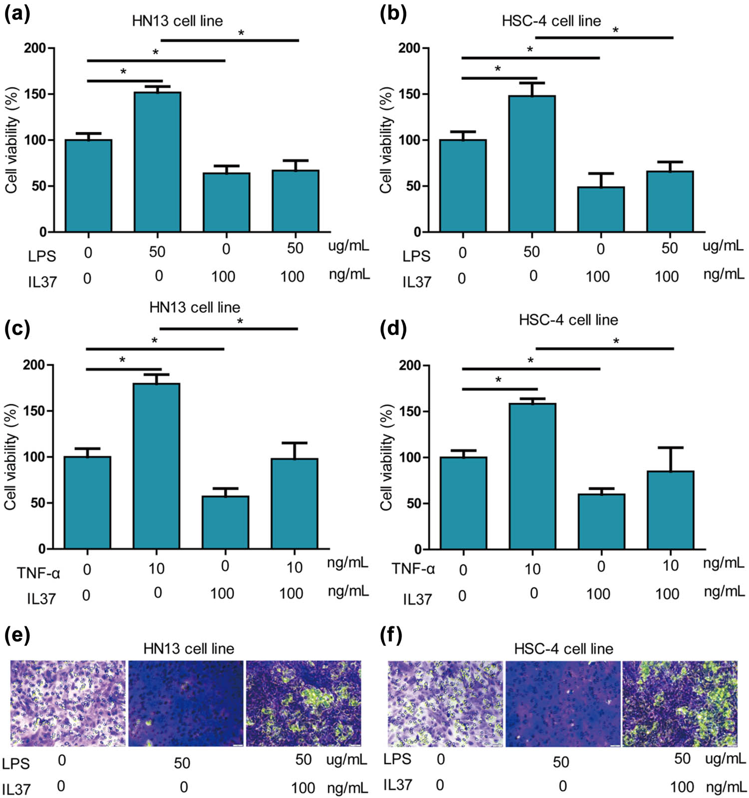 Figure 2
IL-37 alleviated LPS and TNF-α-induced proliferation of oral cancer cells. (a) LPS significantly increased cell viability of HN13 cells, and IL-37 significantly alleviated LPS-induced increase of cell viability of HN13 cells. (b) LPS significantly increased cell viability of HSC-4 cells, and IL-37 significantly alleviated LPS-induced increase of cell viability of HSC-4 cells. (c) TNF-α (20 ng/mL) significantly increased cell viability of HN13 cells, and IL-37 significantly alleviated TNF-α (20 ng/mL)-induced increase of cell viability of HN13 cells. (d) TNF-α (20 ng/mL) significantly increased cell viability of HSC-4 cells, and IL-37 significantly alleviated TNF-α (20 ng/mL)-induced increase of cell viability of HSC-4 cells. (e) LPS (50 μg/mL) potently increased migration of HN13 cells, and IL-37 significantly alleviated TNF-α (20 ng/mL)-induced increase of cell viability of HN13 cells. (f) LPS (50 μg/mL) potently increased migration of HSC-4 cells, and IL-37 significantly alleviated TNF-α (20 ng/mL)-induced increase of cell viability of HSC-4 cells.
