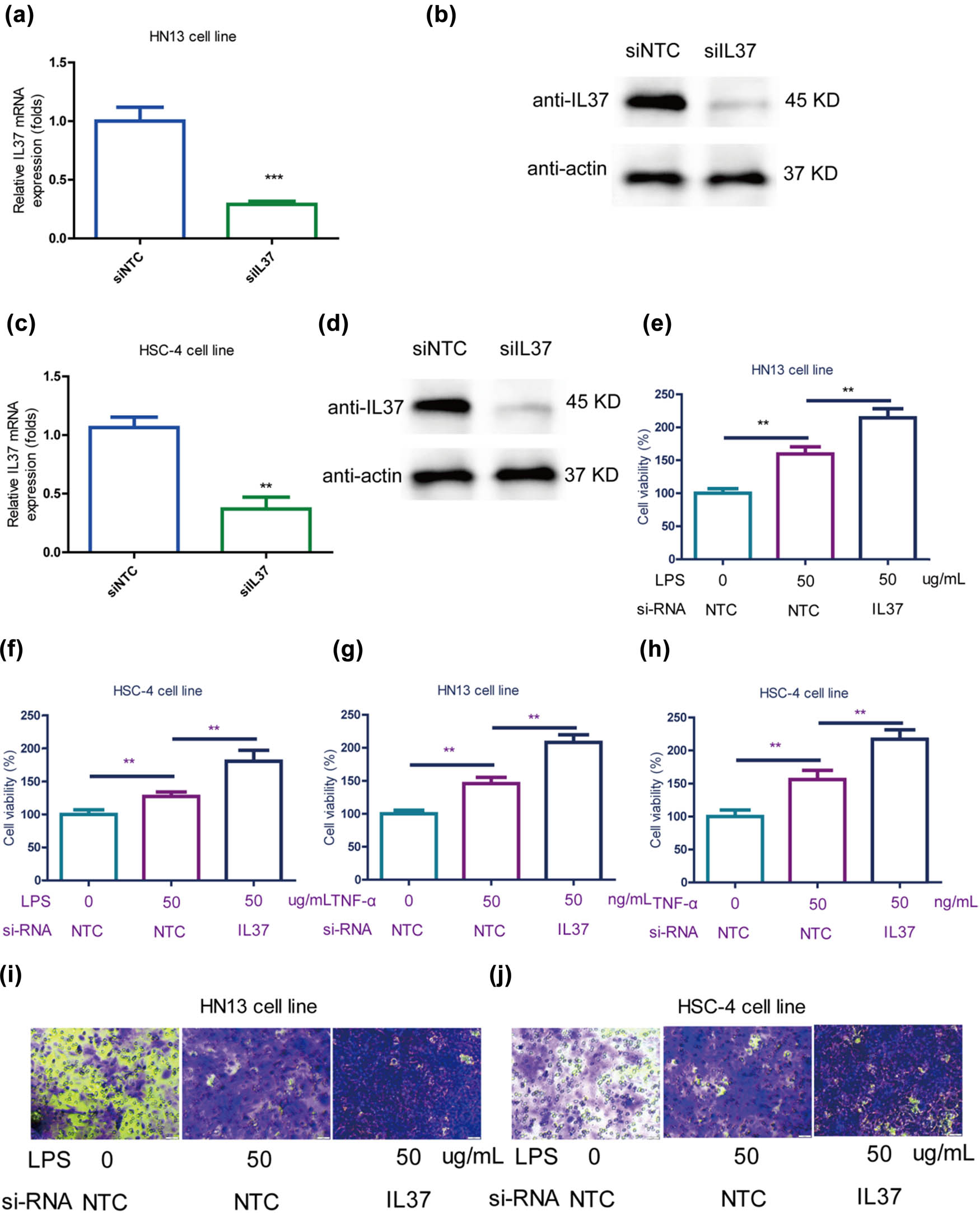 Figure 3
KD of IL-37 exacerbated LPS and TNF-α-induced proliferation of oral cancer cells. (a) IL-37 was knocked-down in HN13 cells detected by qRT-PCR. (b) IL-37 was knocked-down in HN13 cells detected by western blot. (c) IL-37 was knocked-down in HSC-4 cells detected by qRT-PCR. (d) IL-37 was knocked-down in HSC-4 cells detected by western blot. (e) IL-37 further increased LPS-induced promotion on cell viability of HN13 cells. (f) IL-37 further increased LPS-induced promotion on cell viability of HSC-4 cells. (g) L-37 further increased TNF-α (20 ng/mL)-induced promotion on cell viability of HN13 cells. (h) L-37 further increased TNF-α (20 ng/mL)-induced promotion on cell viability of HSC-4 cells. (i) IL-37 KD further increased TNF-α (20 ng/mL)-induced promotion on migration of HN13 cells. (j) IL-37 KD further increased TNF-α (20 ng/mL)-induced promotion on migration of HSC-4 cells.