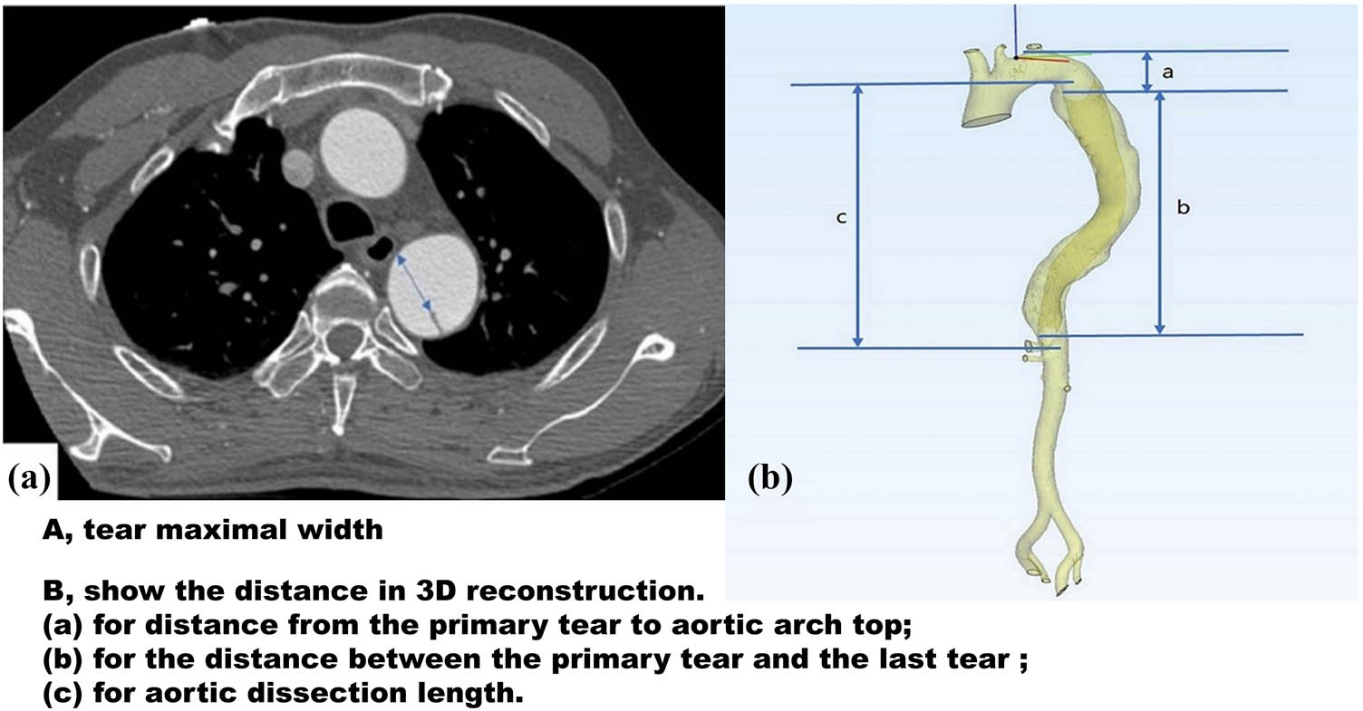 Teaser image from the article