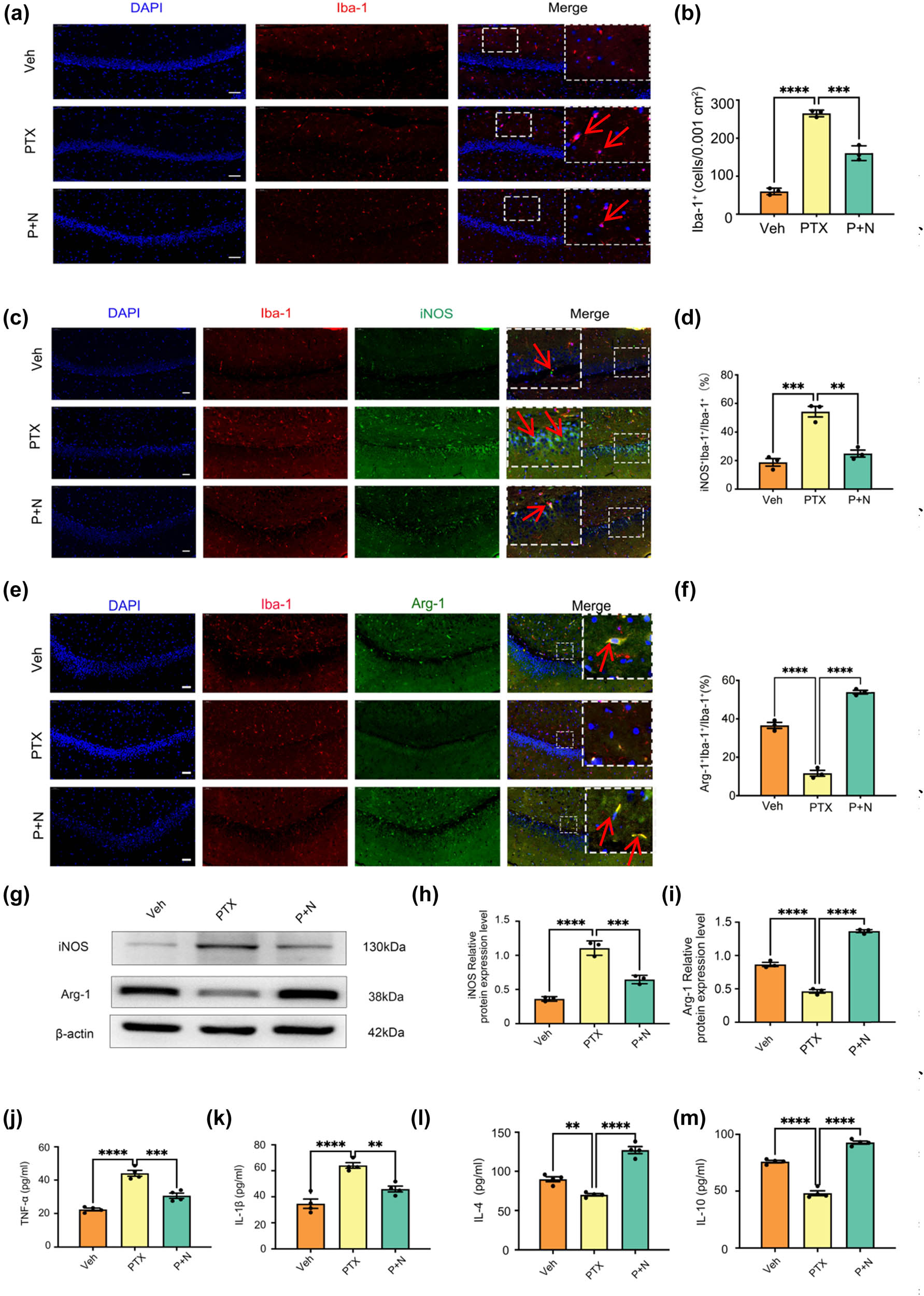 Figure 2 
                  Necroptosis of hippocampal neurons induces microglial polarization toward M1 and inhibits its polarization toward M2. (a) Microphotographs of fluorescent immunohistochemical staining showing labeling of Iba-1 (red). Bar = 50 µm, n = 3 mice/group. (b) Number of microglial cells. Results were expressed as the Mean ± SEM, n = 3 mice/group, ***P < 0.001, ****P < 0.0001. Abbreviation: Veh, vehicle; PTX, paclitaxel; P + N, paclitaxel + necrostatin-1. (c) Microphotographs of fluorescent immunohistochemical staining showing double labeling of iNOS (green) and Iba-1 (red). Bar = 50 µm. (d) Number of microglial cells and iNOS co-labeled cells as a percentage of the number of microglial cells. Results were expressed as the Mean ± SEM, n = 3 mice/group. (e) Microphotographs of fluorescent immunohistochemical staining showing double labeling of Arg-1 (green) and Iba-1 (red). Bar = 50 µm. (f) Number of microglial cells and Arg-1 co-labeled cells as a percentage of the number of microglial cells. Results were expressed as the Mean ± SEM, n = 3 mice/group. (g)–(i) Western blot expression of iNOS and Arg-1 in the hippocampus of mice in different groups. (j) and (k) Effects on the levels of inflammatory molecules TNF-α and IL-1β secreted by M1 microglia in the hippocampus of mice in different groups. All data are shown as the Mean ± SEM, n = 3 for each group. (l) and (m) Effects on the levels of anti-inflammatory molecules IL-4 and IL-10 secreted by M2 microglia in the hippocampus of mice in different groups. All data are shown as the Mean ± SEM, n = 3 for each group.
               