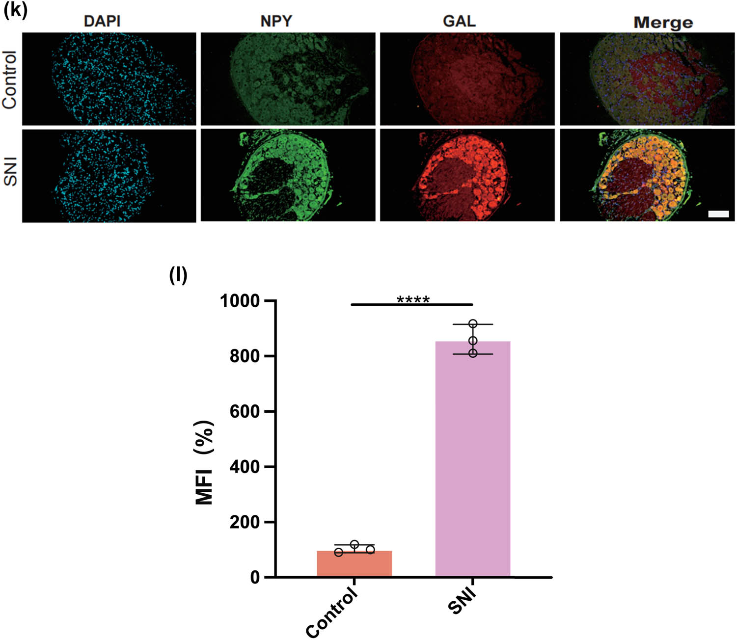 Figure 4
Prediction of the differentiation of SC subtypes. (a) Monocle pseudotime analysis revealing the progression of six SC subtypes; (b) ridge plot of six SC subtypes; (c) heatmap showing the scaled expression of differently expressed genes in three clusters as in (b); (d) relative gene expression levels of Gal and Npy across different cell types.; (e)–(j) dot plot revealing the top 10 marker genes of indicated SC subtypes in control and SNI mice; (k) immunofluorescence staining of NPY and GAL. Scale bar = 20 μm. (l) Quantification of K.