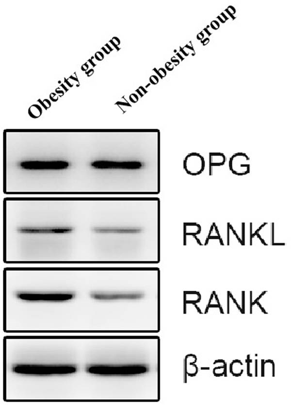 Figure 2 
                  Expression levels of the RANK, RANKL, and OPG proteins in the two groups.
               