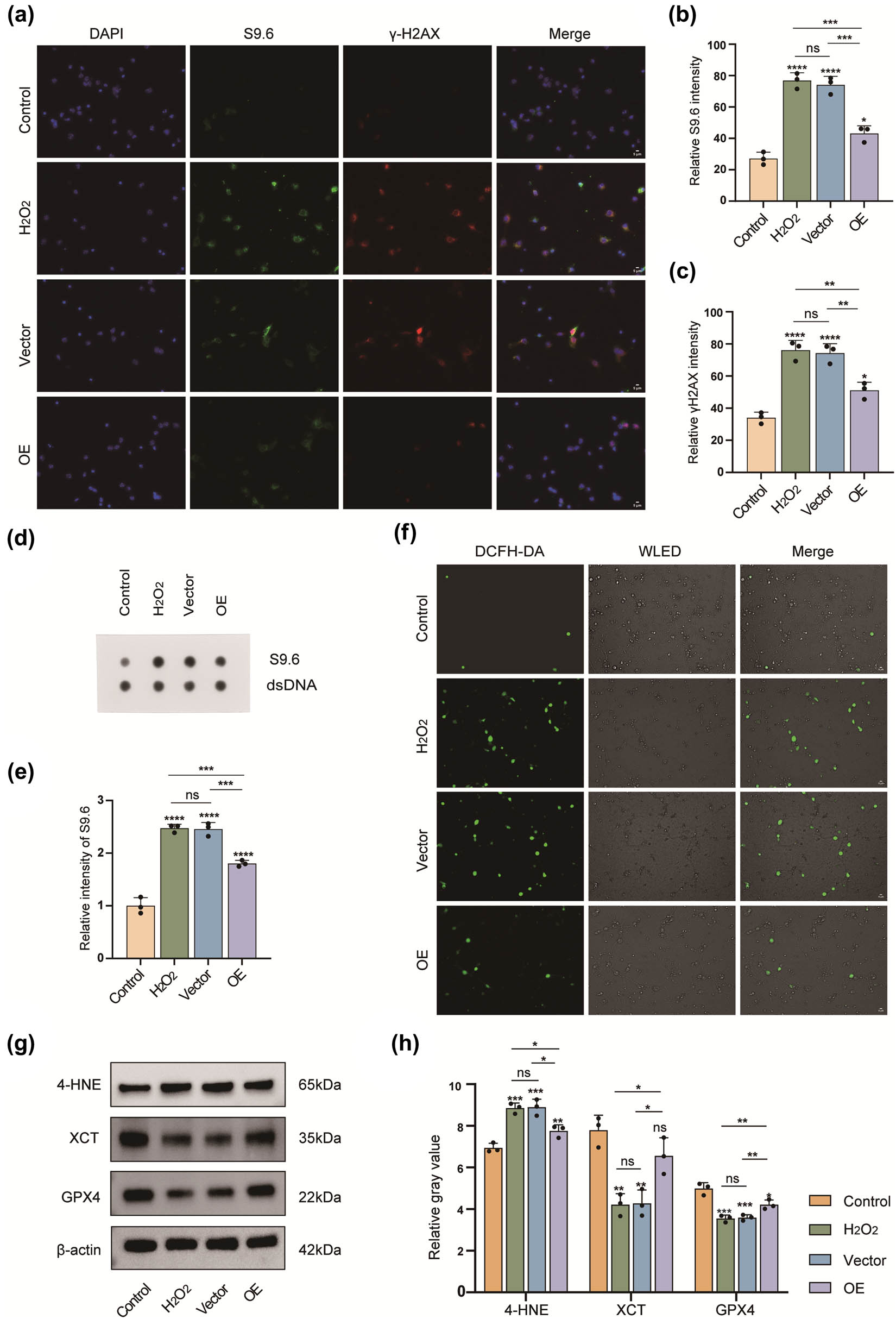 Figure 3 
                  Overexpression of FAHD1 reduces R-loop formation and DNA injury, while also mitigating ferroptosis. IF was performed to detect S9.6 and γ-H2AX expression, followed by semi-quantitative analysis, scale bar: 5 μm (a)–(c). Dot blot analysis and semi-quantitative analysis were conducted to assess R-loops using an antibody against S9.6, with dsDNA as an internal loading control (d) and (e). DCFH-DA assay employed to evaluate the production of ROS, scale bar: 5 μm (f). 4-HNE, XCT, and GPX4 expression levels were detected by western blotting and semi-quantitative analysis (g) and (h) (n = 3, one-way ANOVA, p < 0.05, **p < 0.01, ***p < 0.001, ****p < 0.0001, and ns, not significant).
               