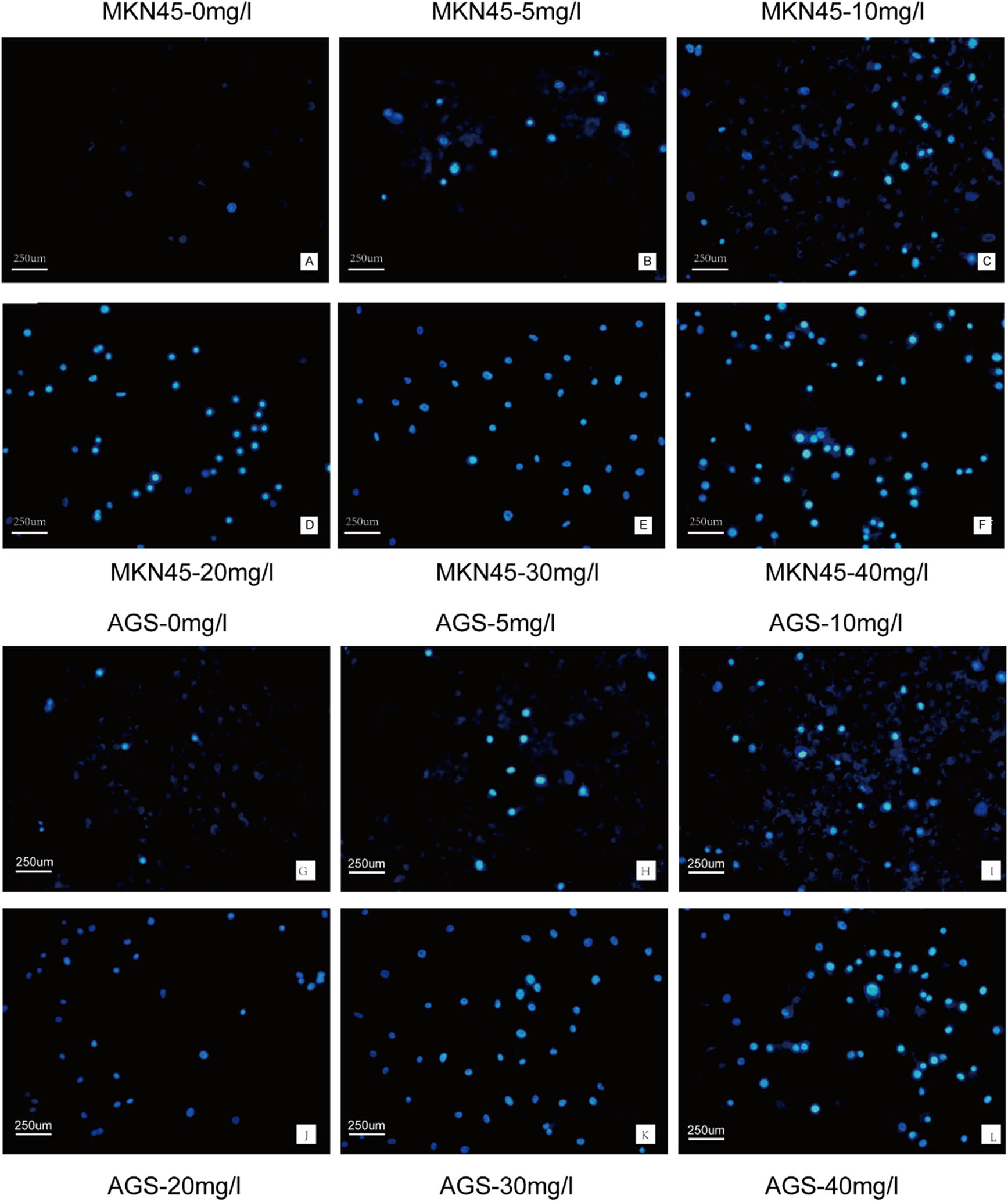 Figure 3 
                  H2valdien3 induces apoptosis in MKN45 and AGS cells. MKN45 and AGS cells were stained with bisbenzimide trihydrochloride (Hoechst 33258) to evaluate apoptosis. (a)–(f) MKN45 cells and (g)–(l) AGS cells were cultured in six-well plates for 24 h and then treated with different concentrations of H2valdien3 (5–40 mg/L) for 48 h. The cells were observed under a microscope, and apoptosis increased with ascending drug concentrations.
               