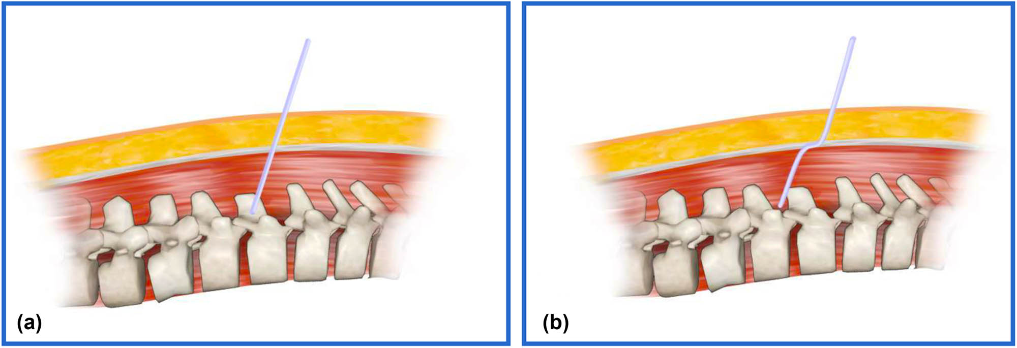 Teaser image from the article