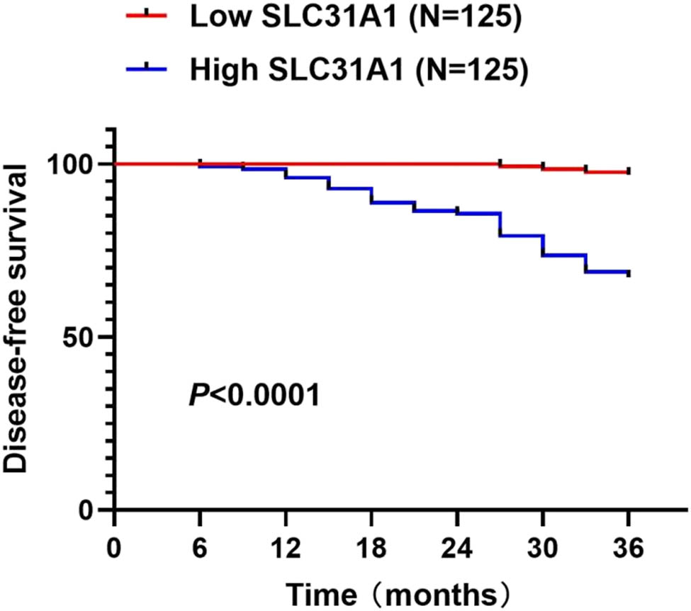 Figure 2 
                  DFS according to SLC31A1 expression levels in PTC.